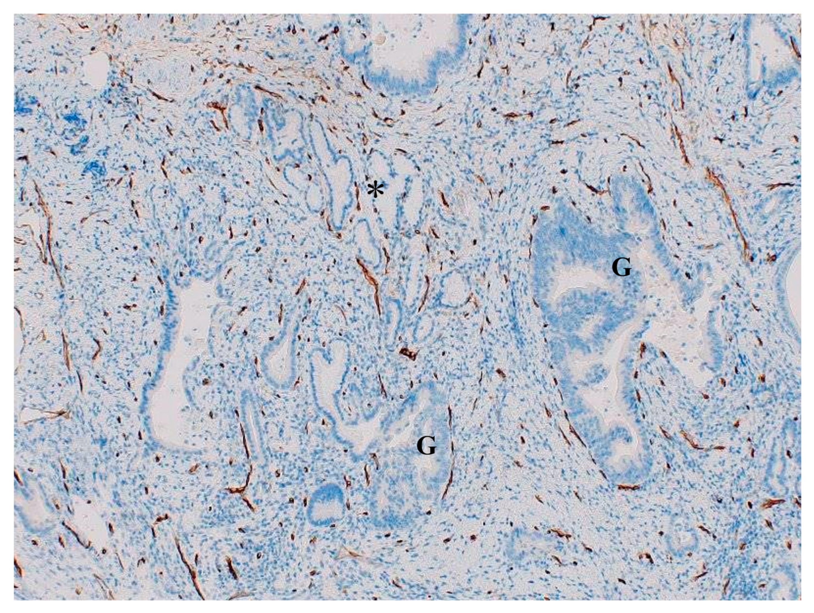 Cancers 16 03869 g006