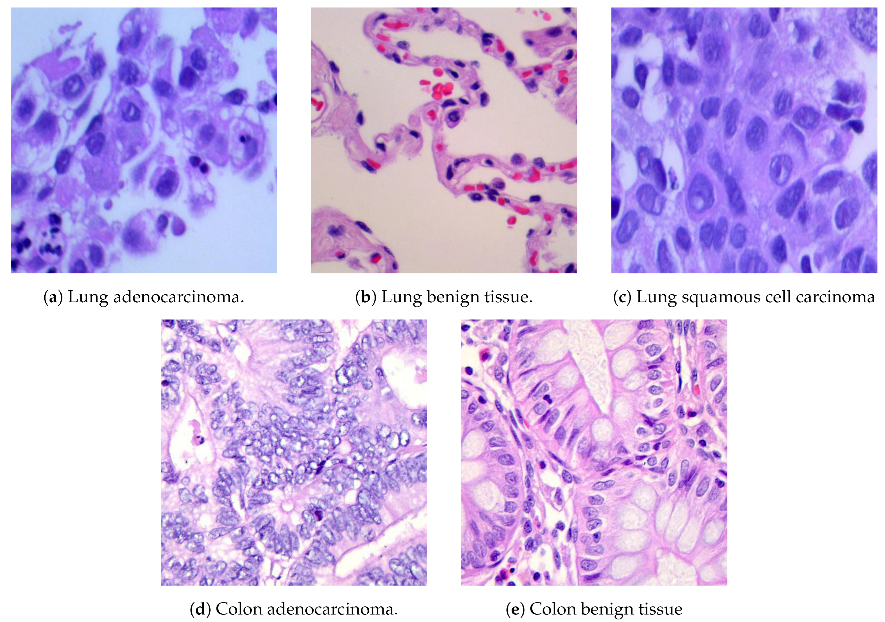 Cancers 16 03879 g006