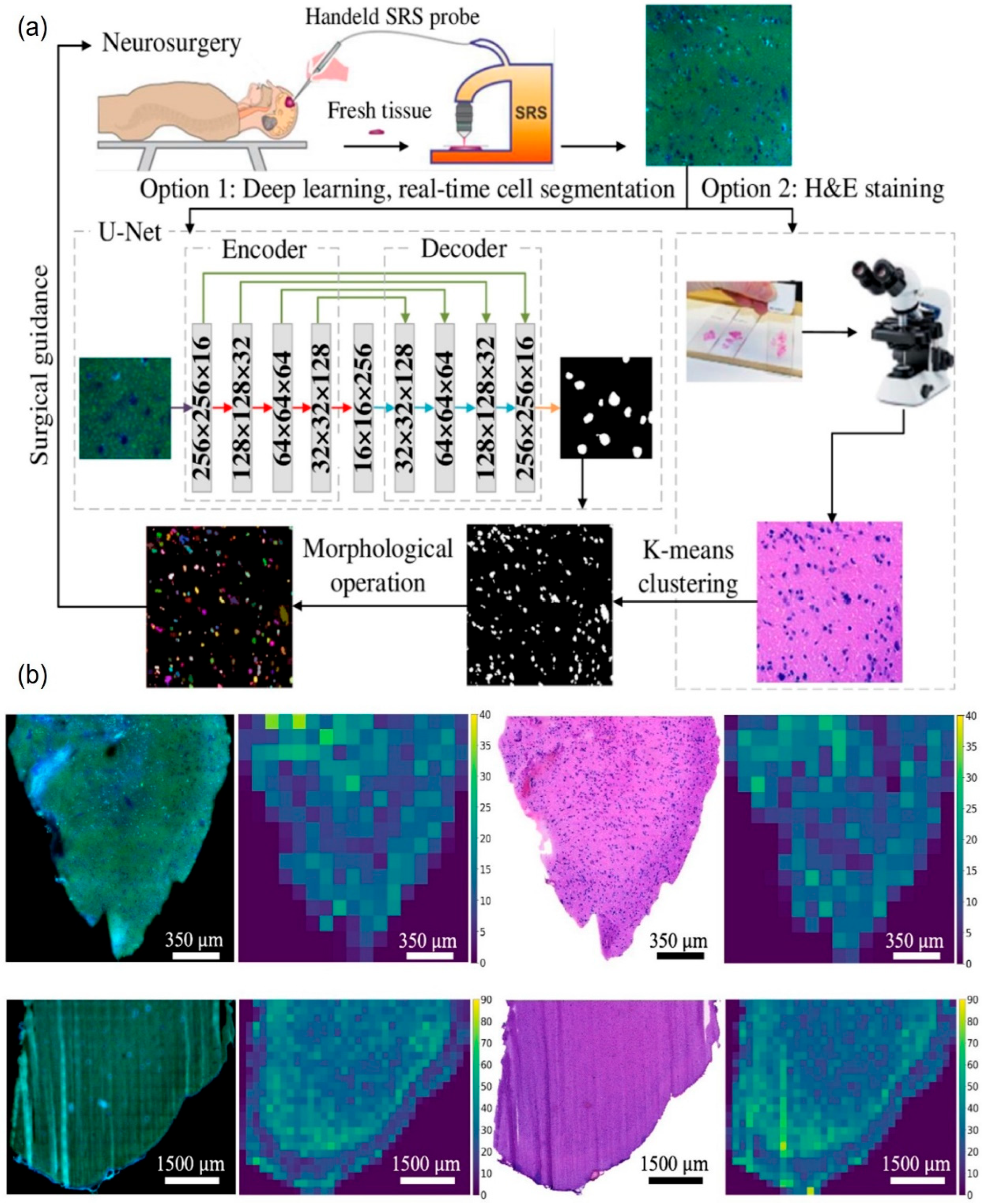 Cancers 16 03917 g004