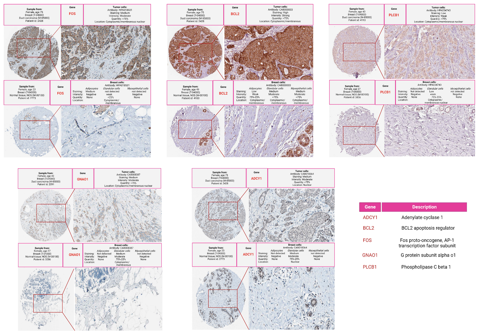 Cancers 16 03962 g006