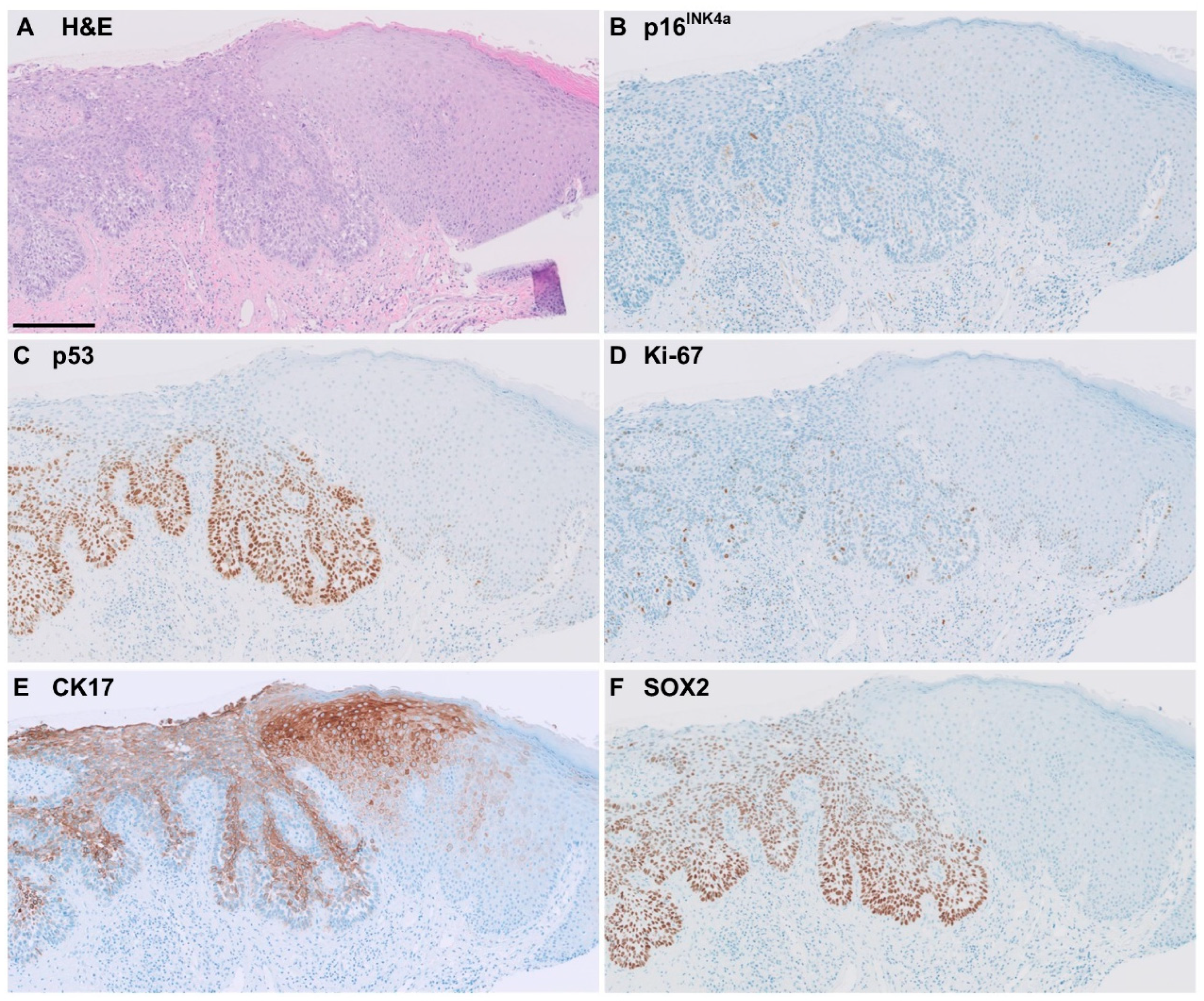 Cancers 16 03966 g002