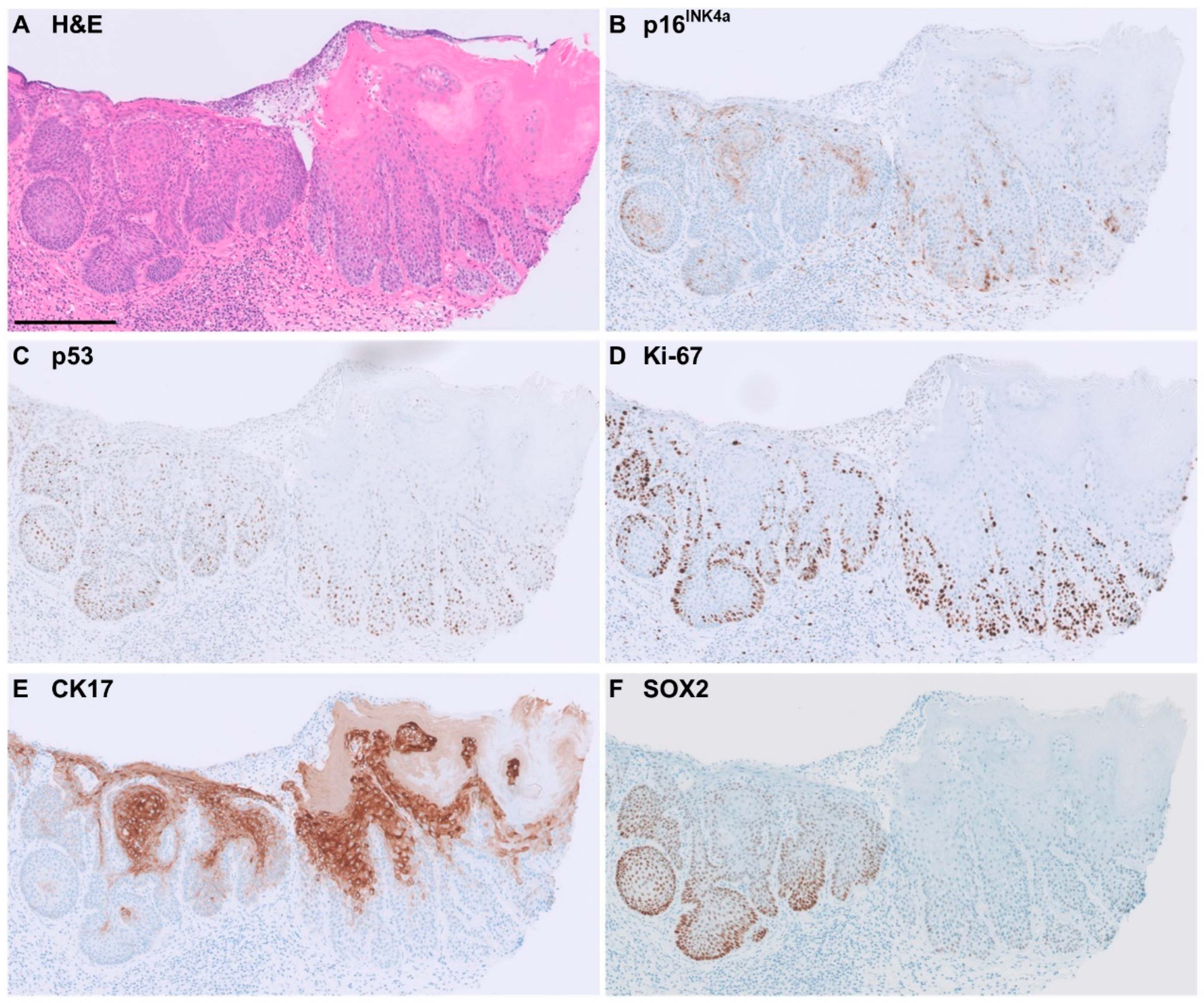 Cancers 16 03966 g003