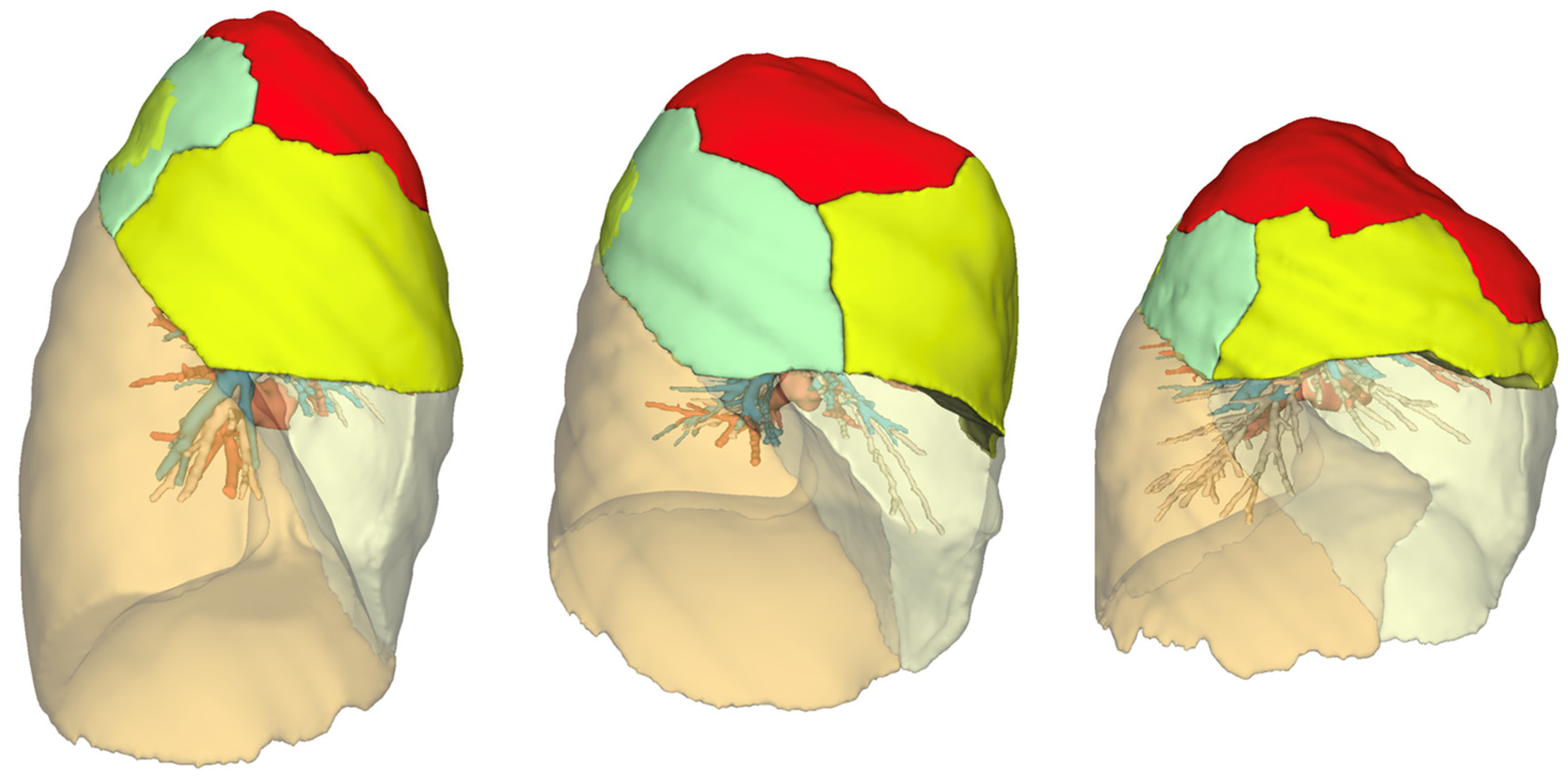 Cancers 16 03981 g002