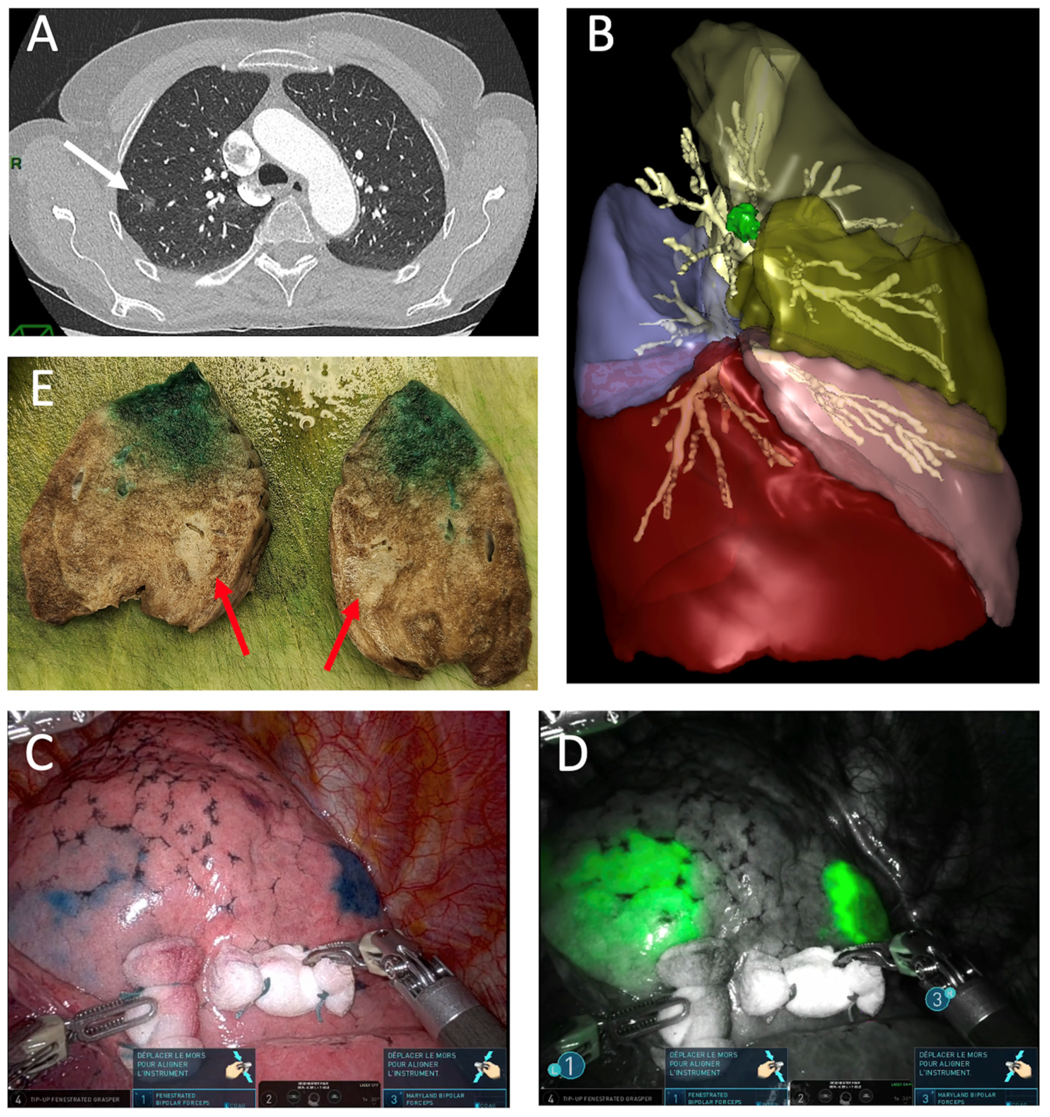 Cancers 16 03981 g003