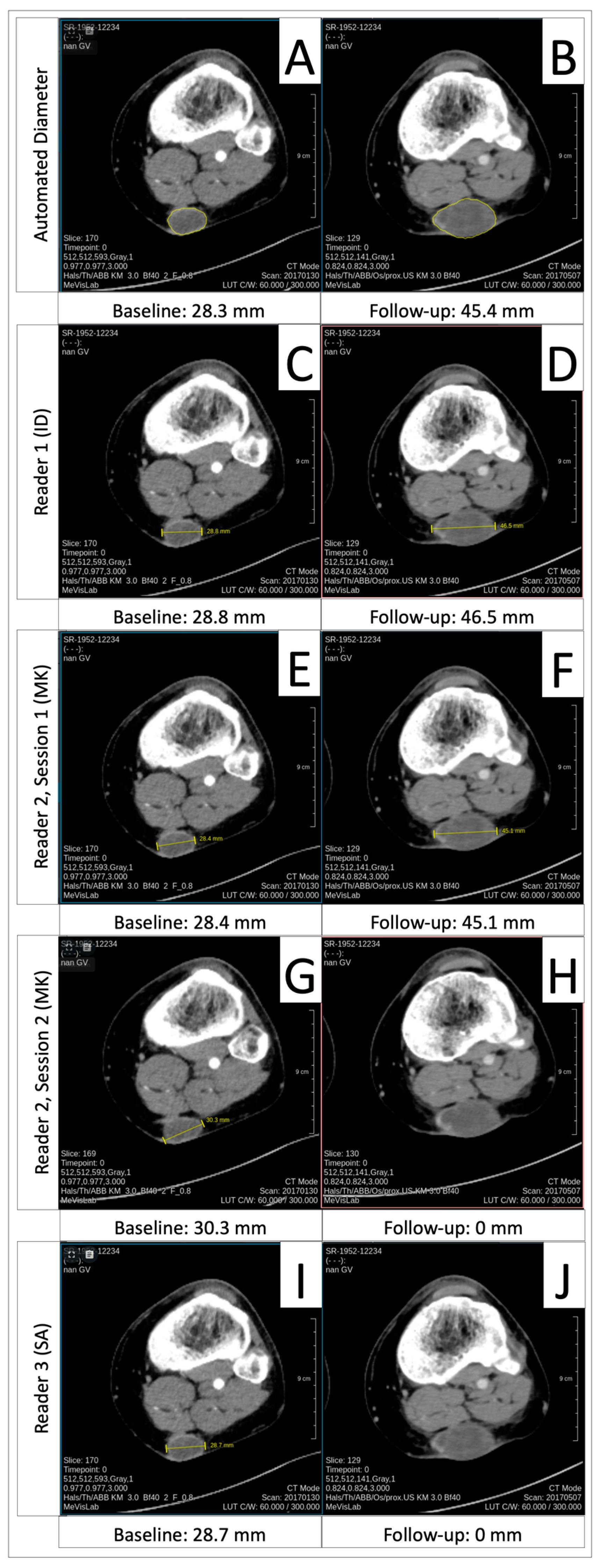 Cancers 16 04009 g0a2