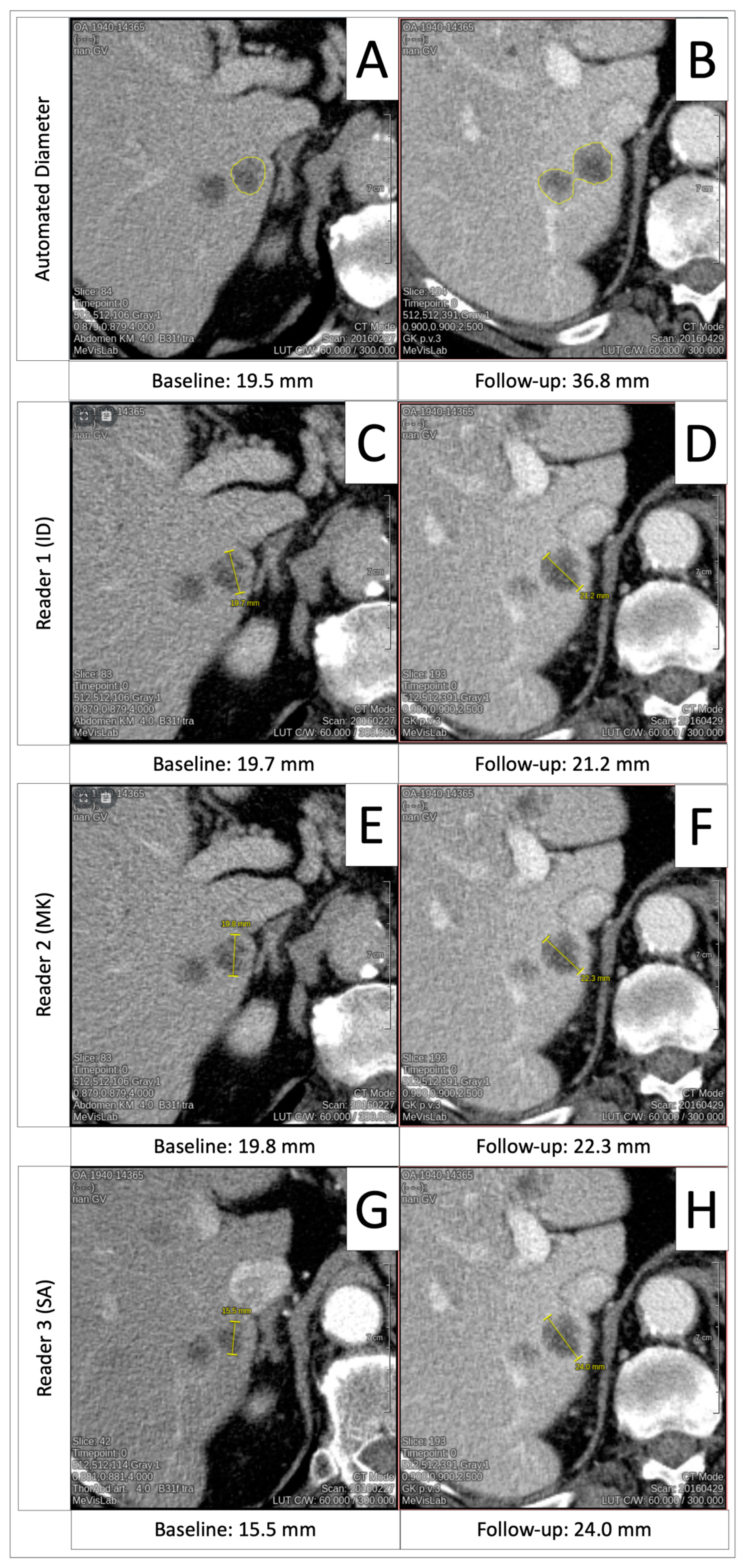 Cancers 16 04009 g0a3