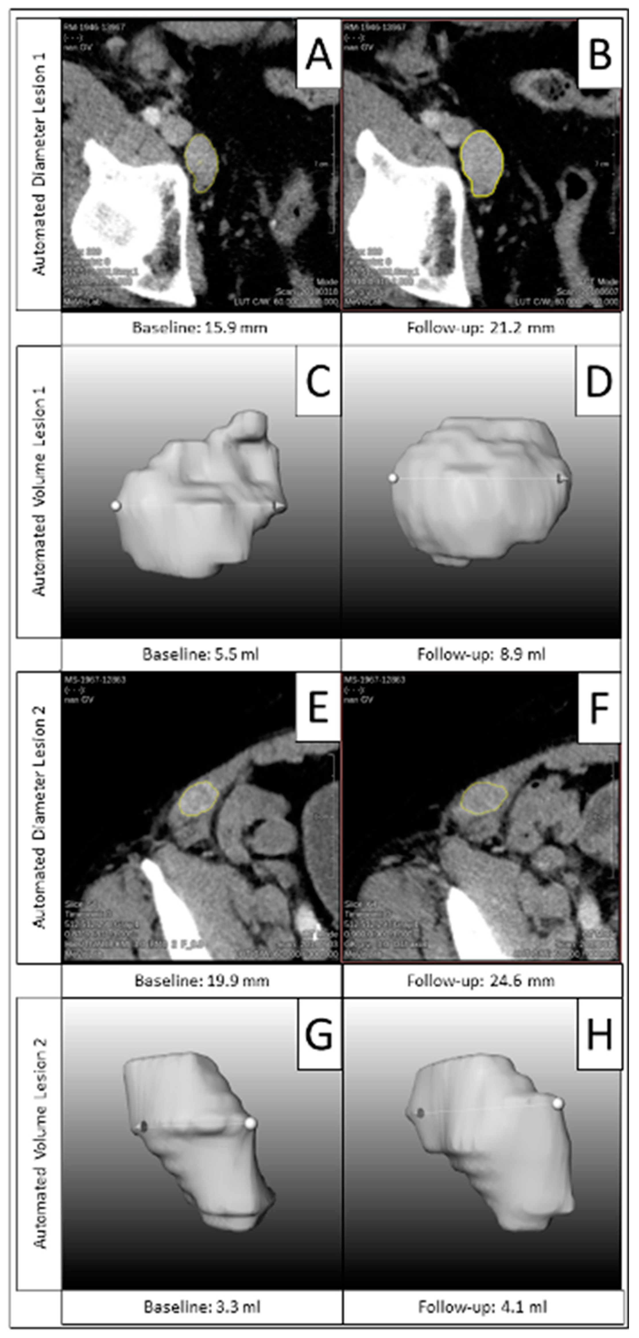 Cancers 16 04009 g0a4