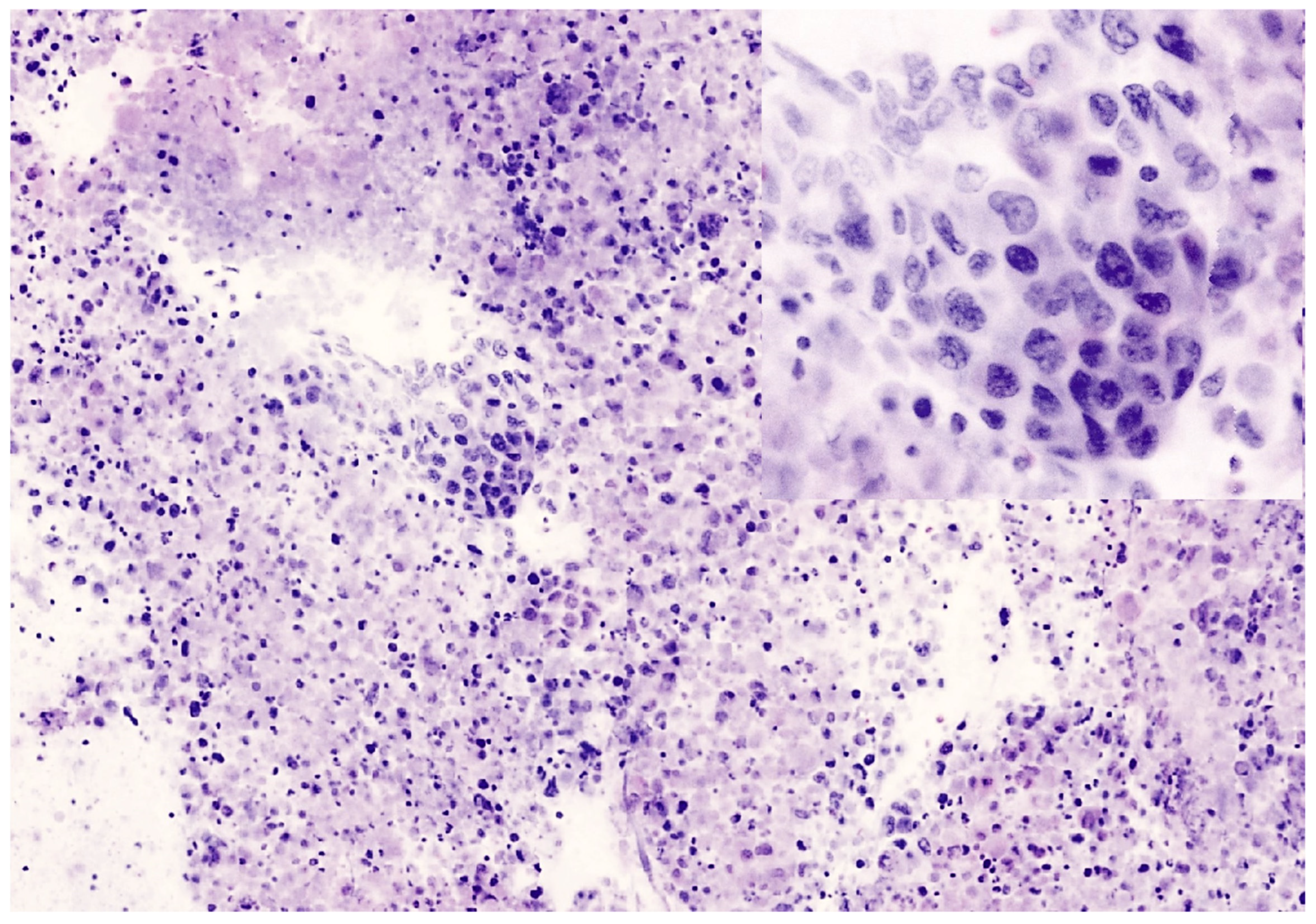 Cancers 16 04015 g005