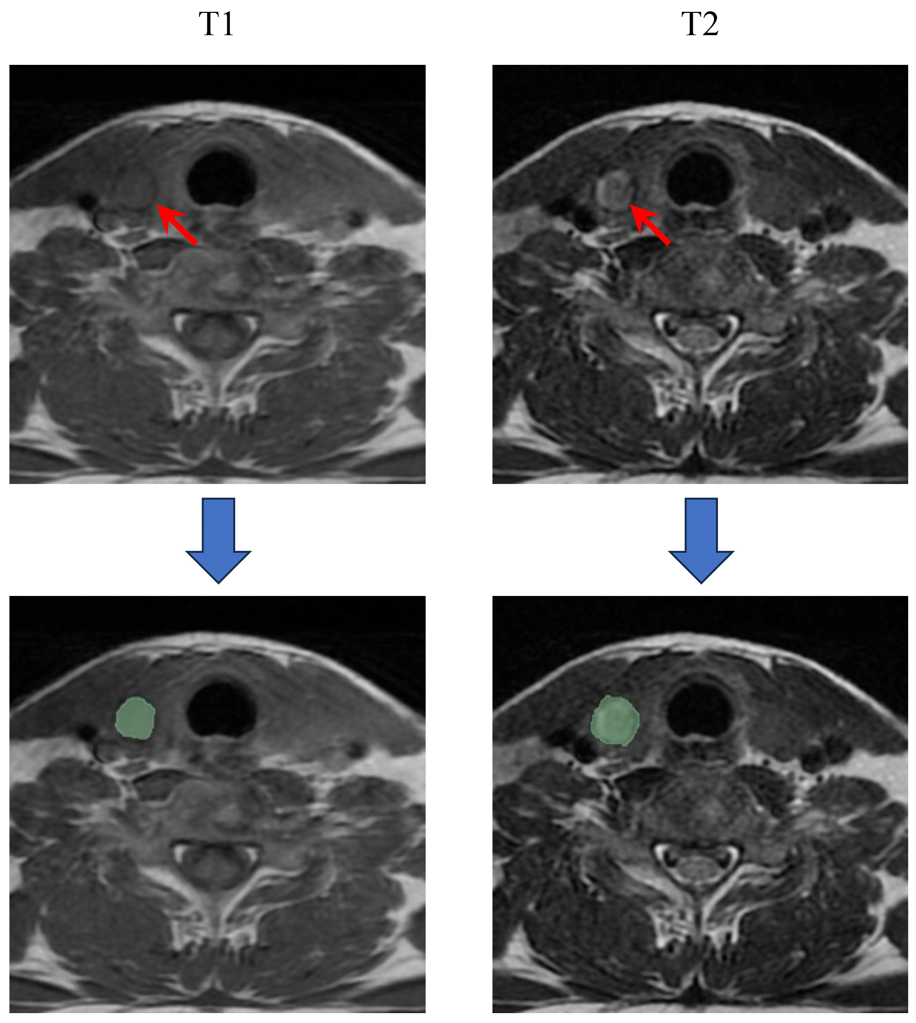 Cancers 16 04042 g002