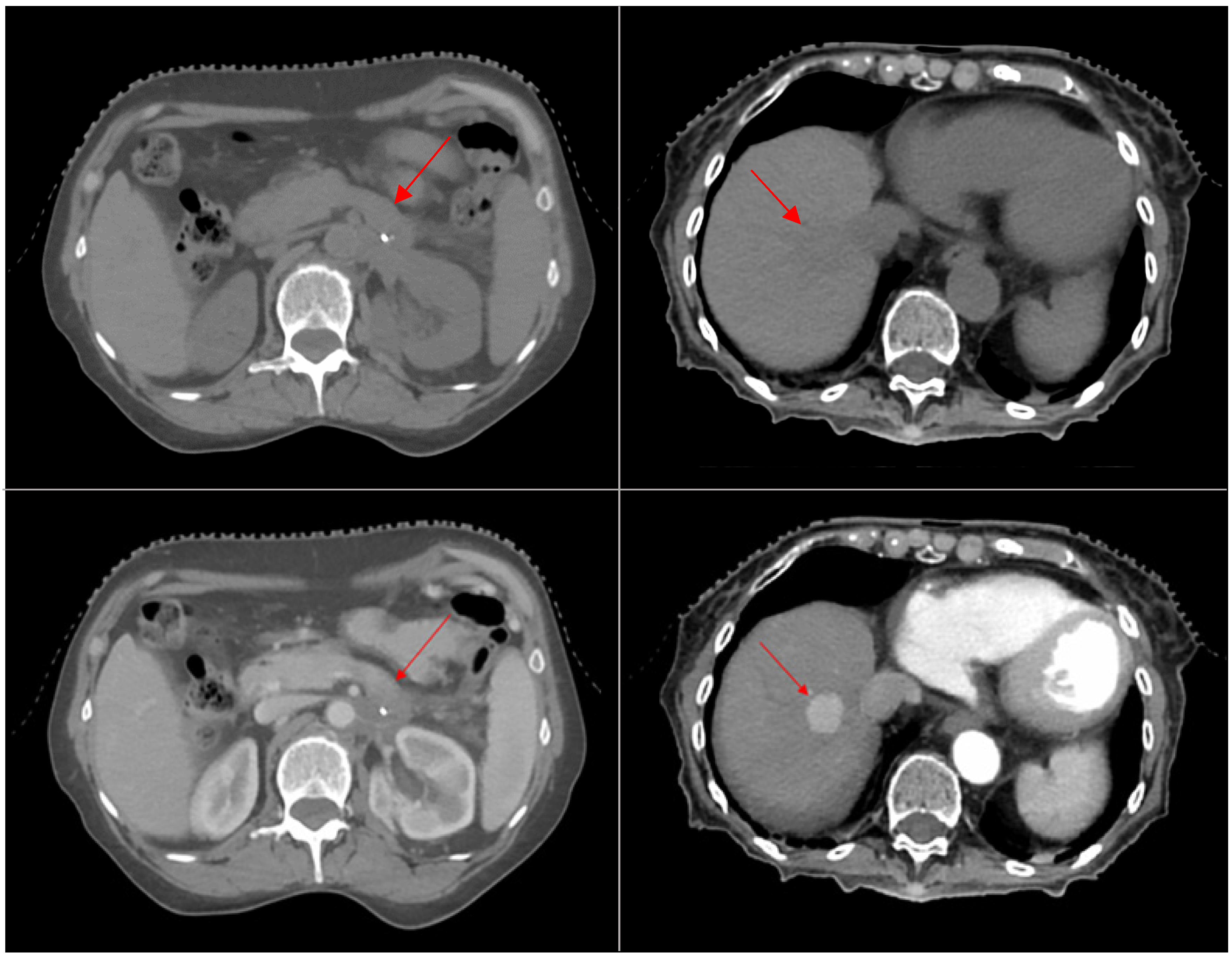 Cancers 16 04066 g002