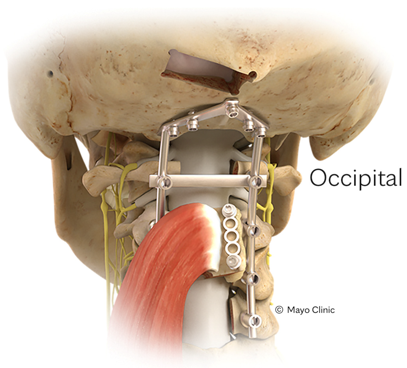 Cancers 16 04088 g005