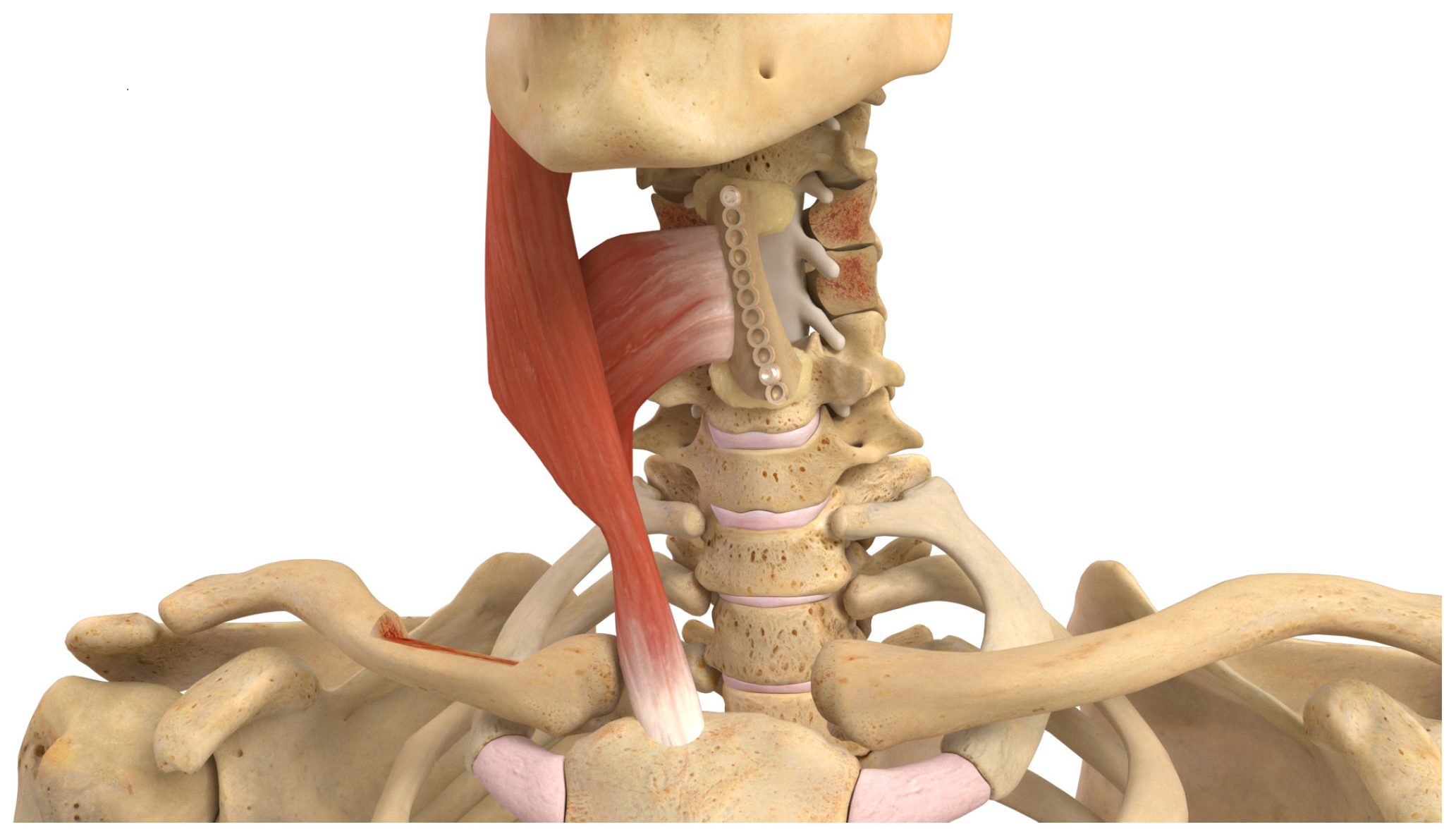 Cancers 16 04088 g006