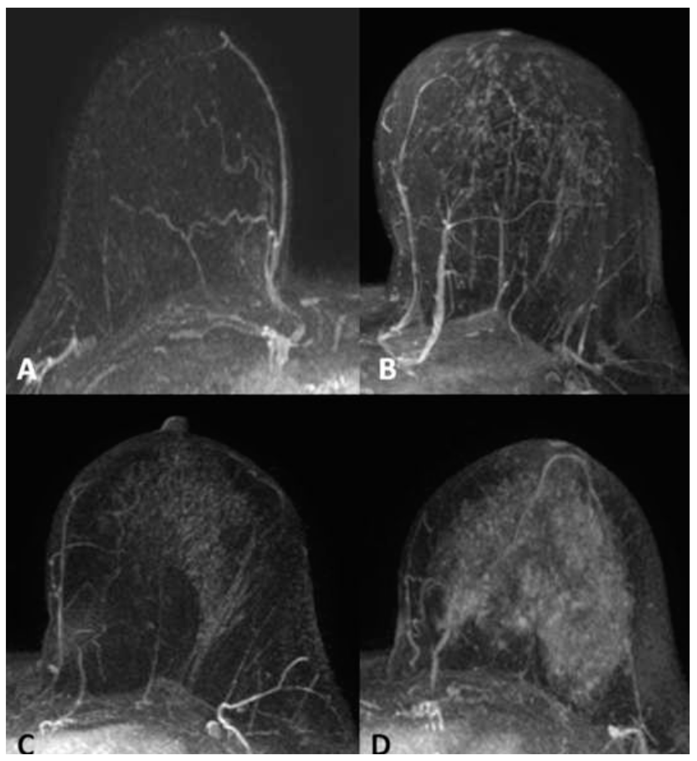 Cancers 16 04091 g001 Cancers 16 04091 g001