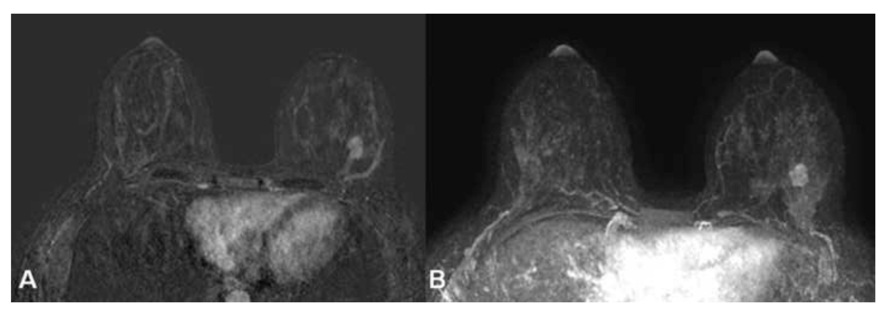 Cancers 16 04091 g002 Cancers 16 04091 g002