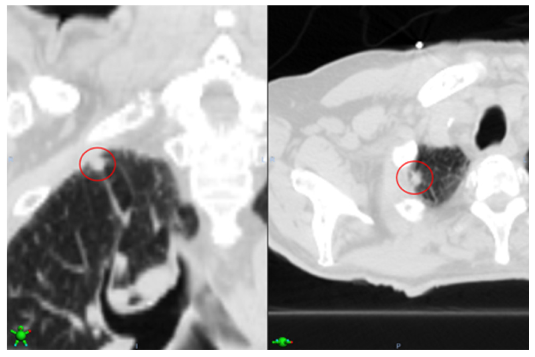 Cancers 16 04097 g005