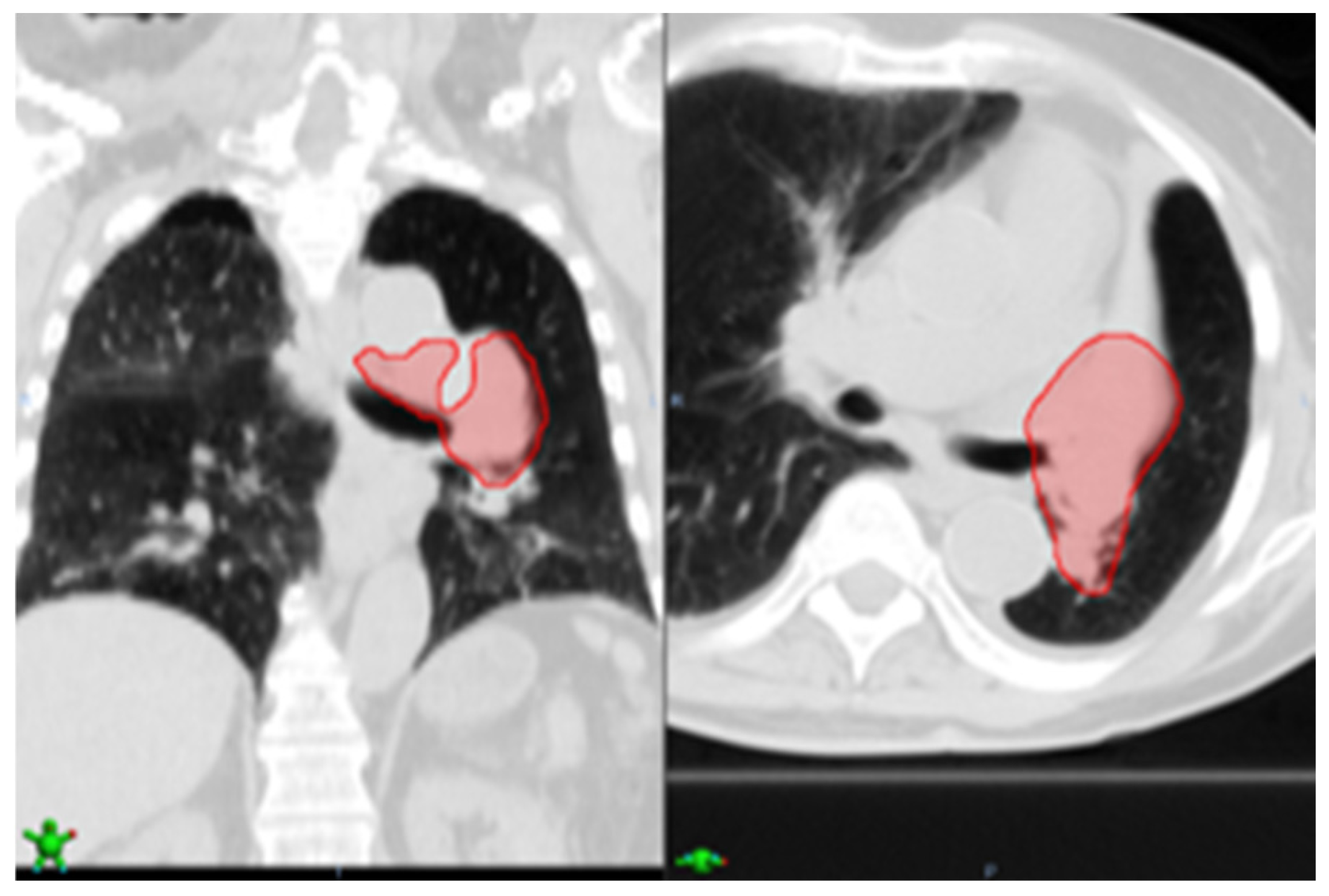 Cancers 16 04097 g006