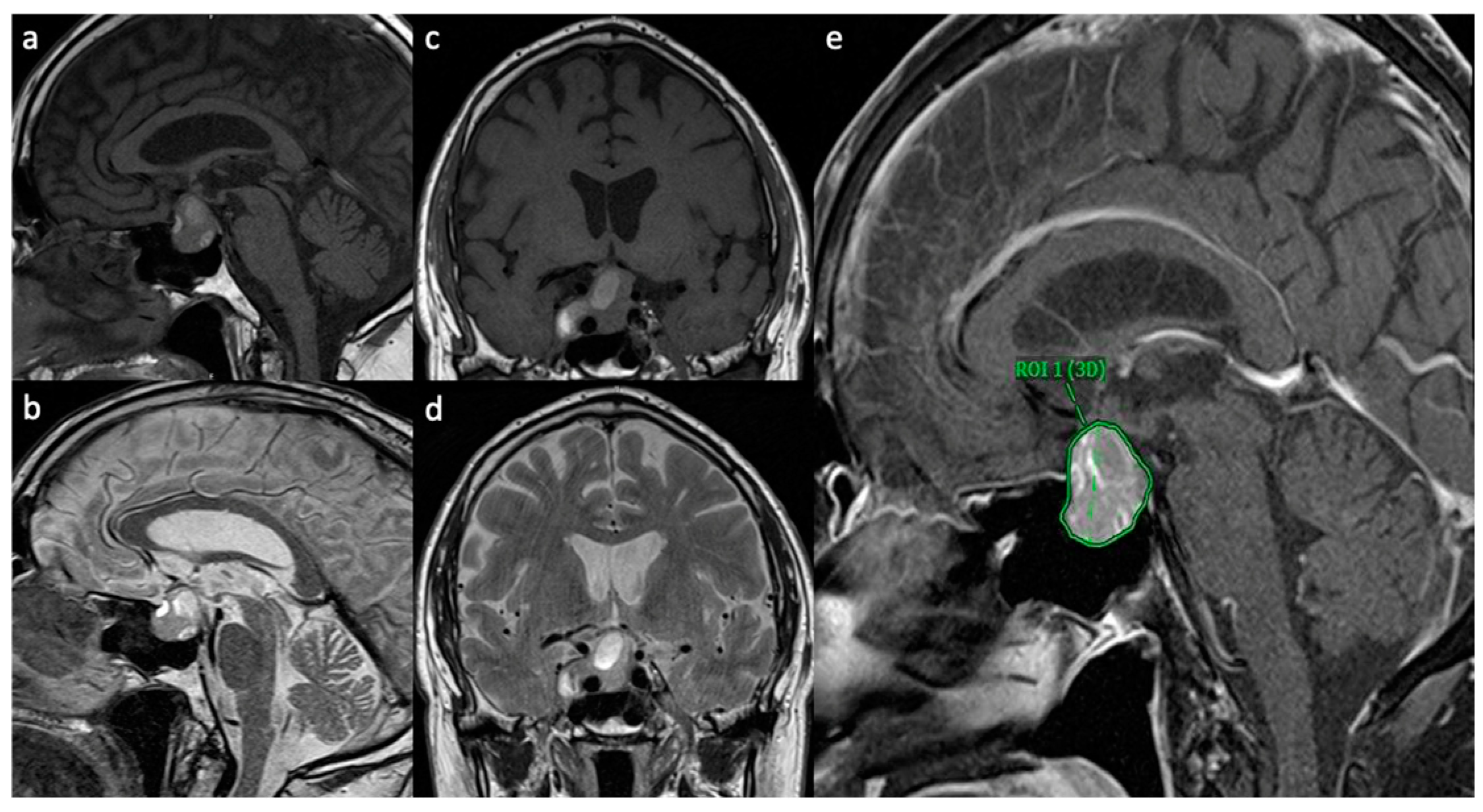 Cancers 16 04105 g001