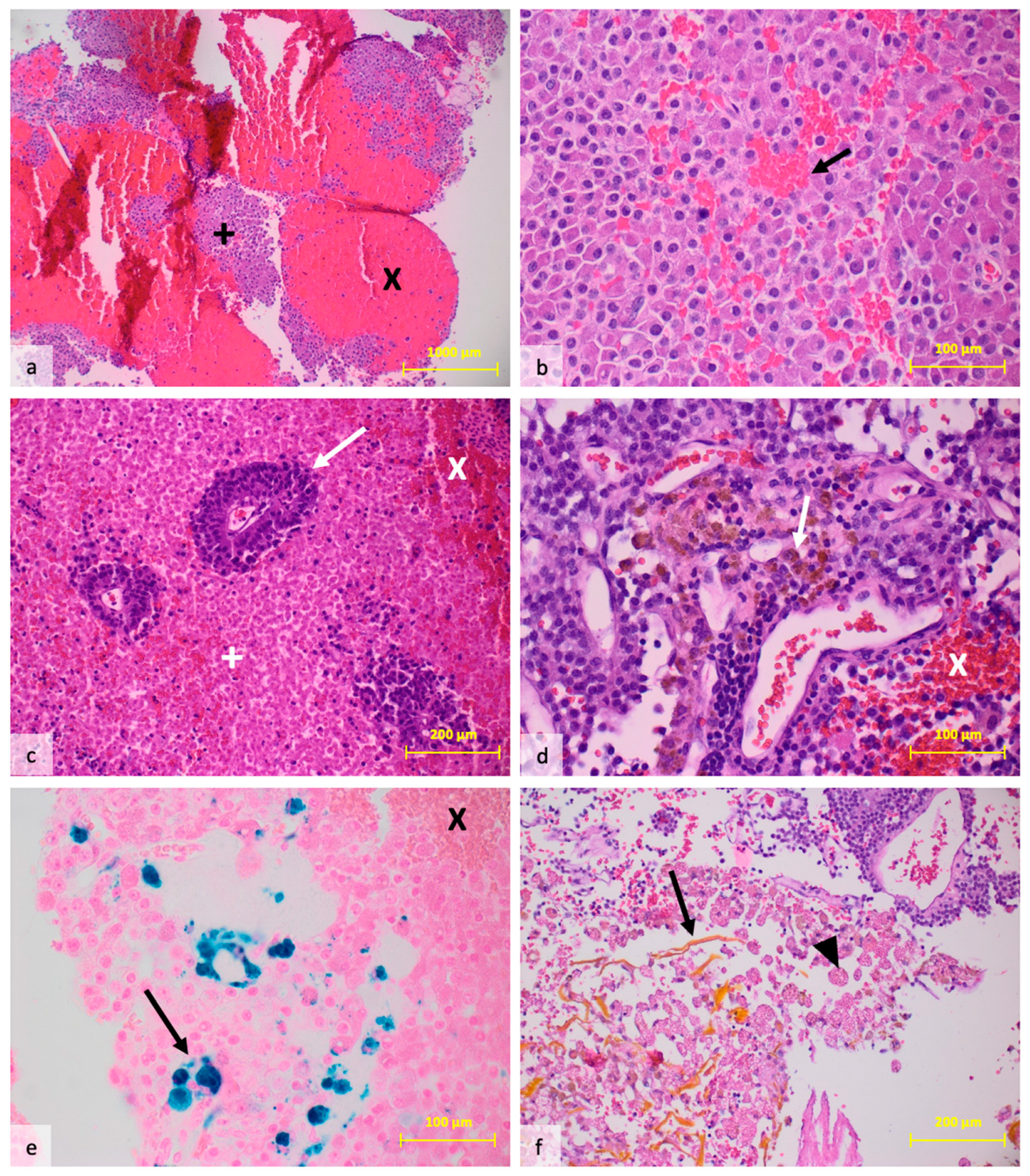 Cancers 16 04105 g002