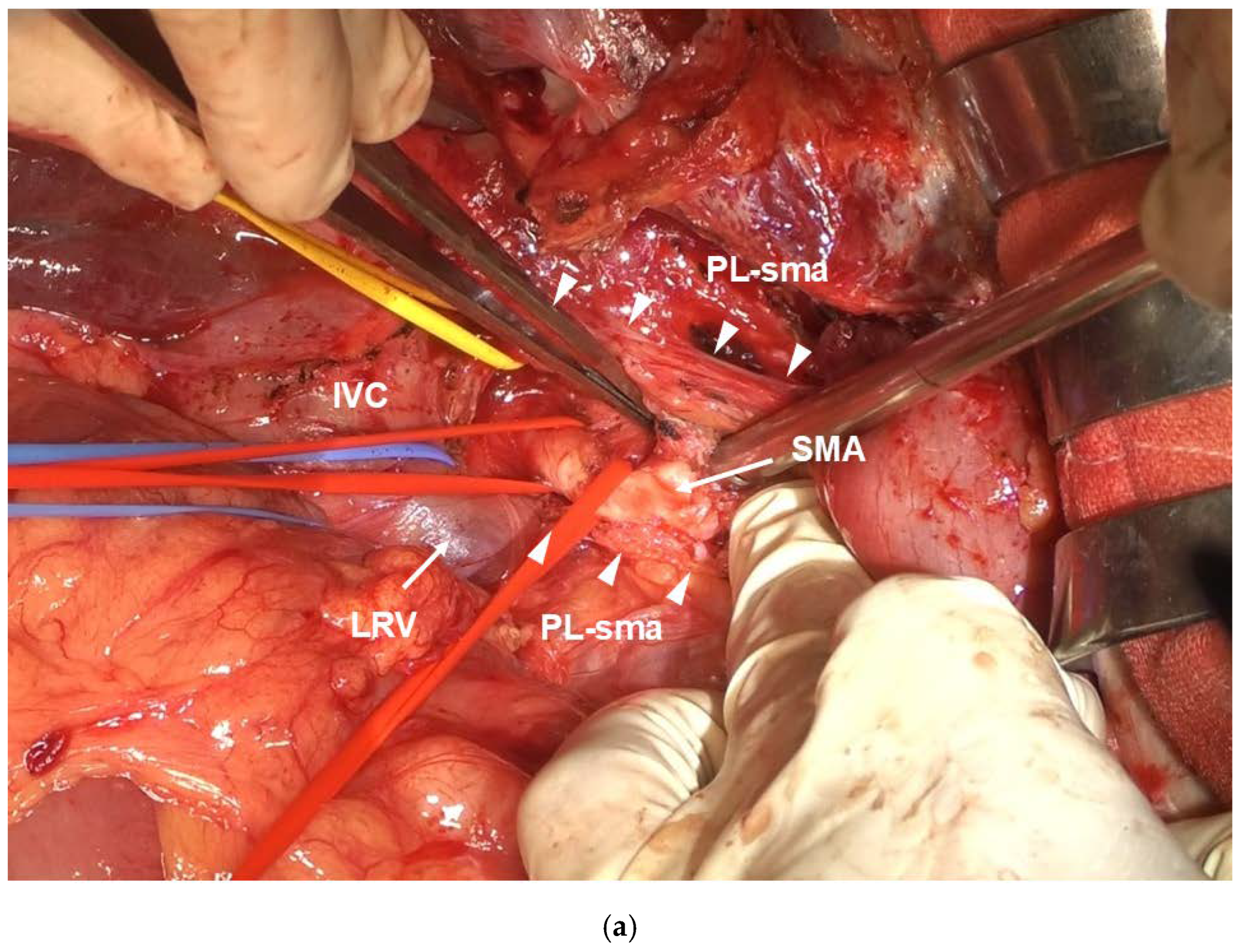 Cancers 16 04115 g003a