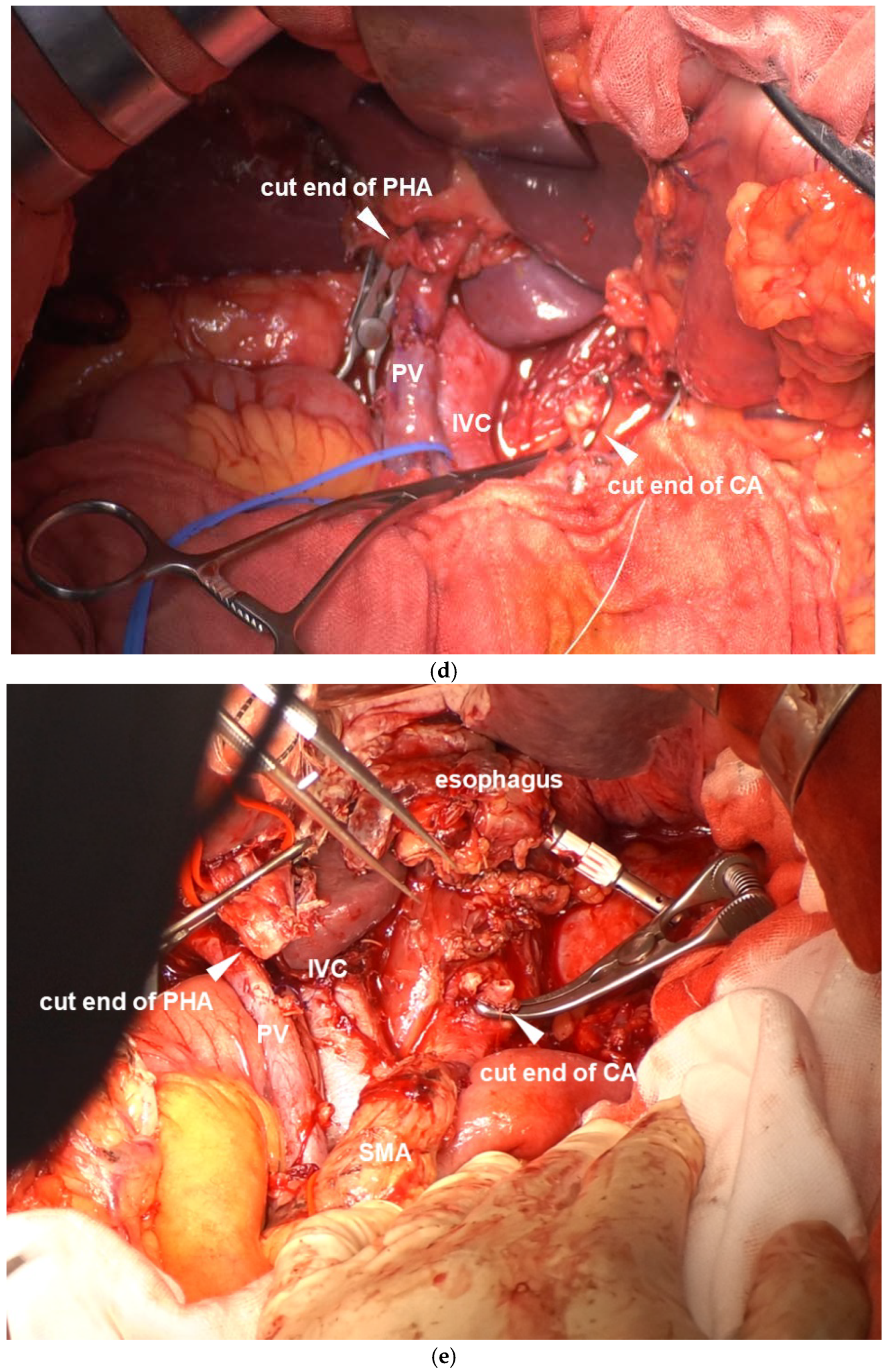 Cancers 16 04115 g003c