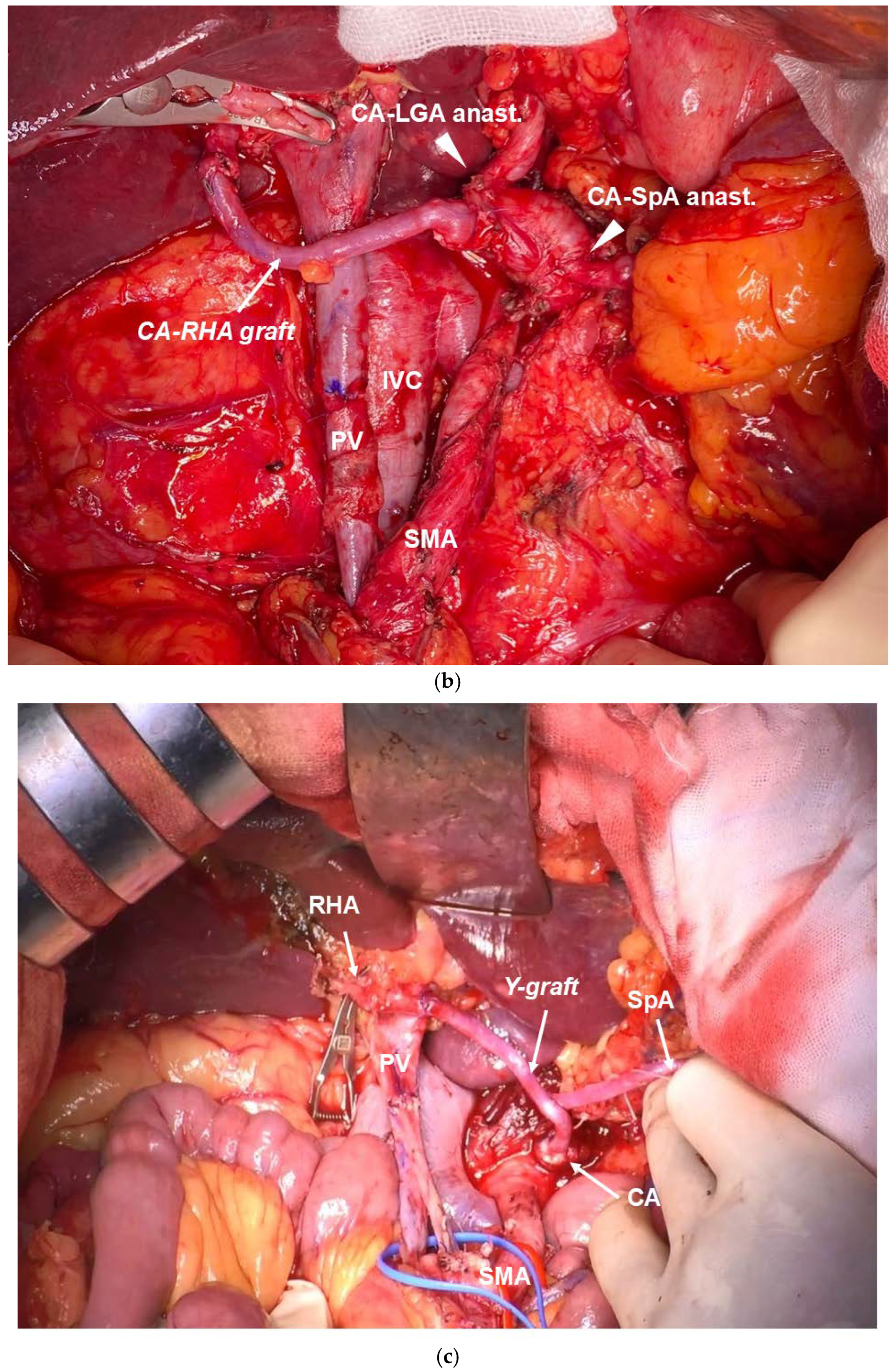 Cancers 16 04115 g004b
