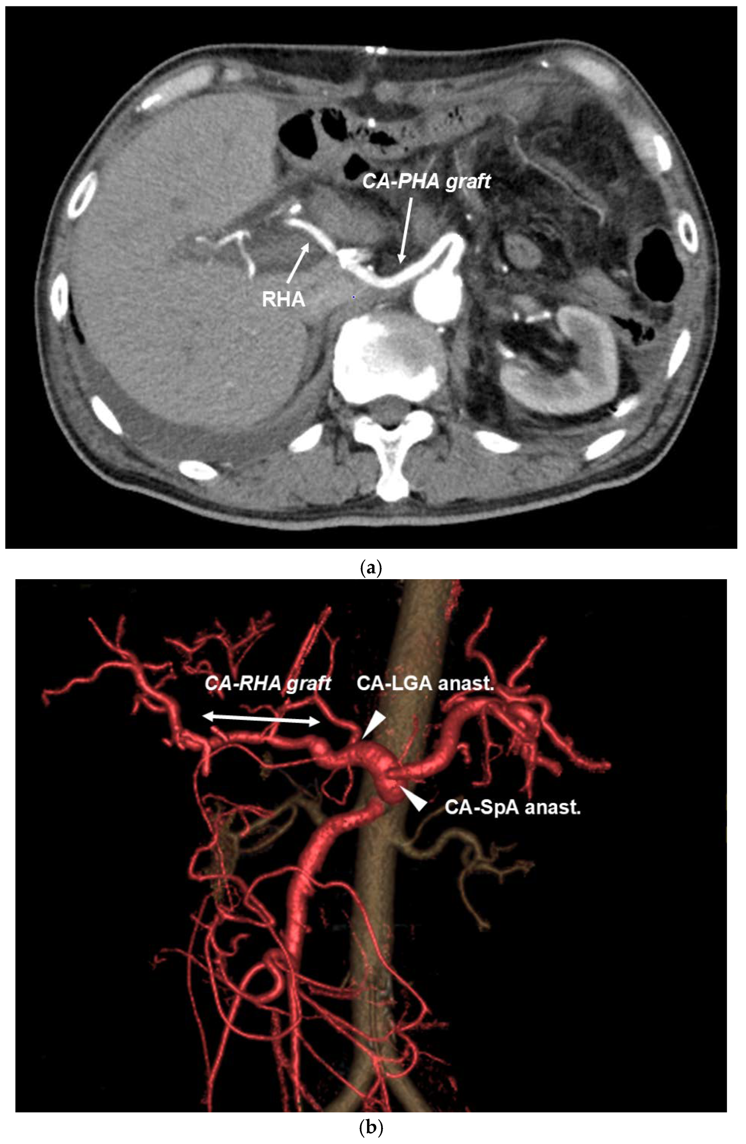 Cancers 16 04115 g005