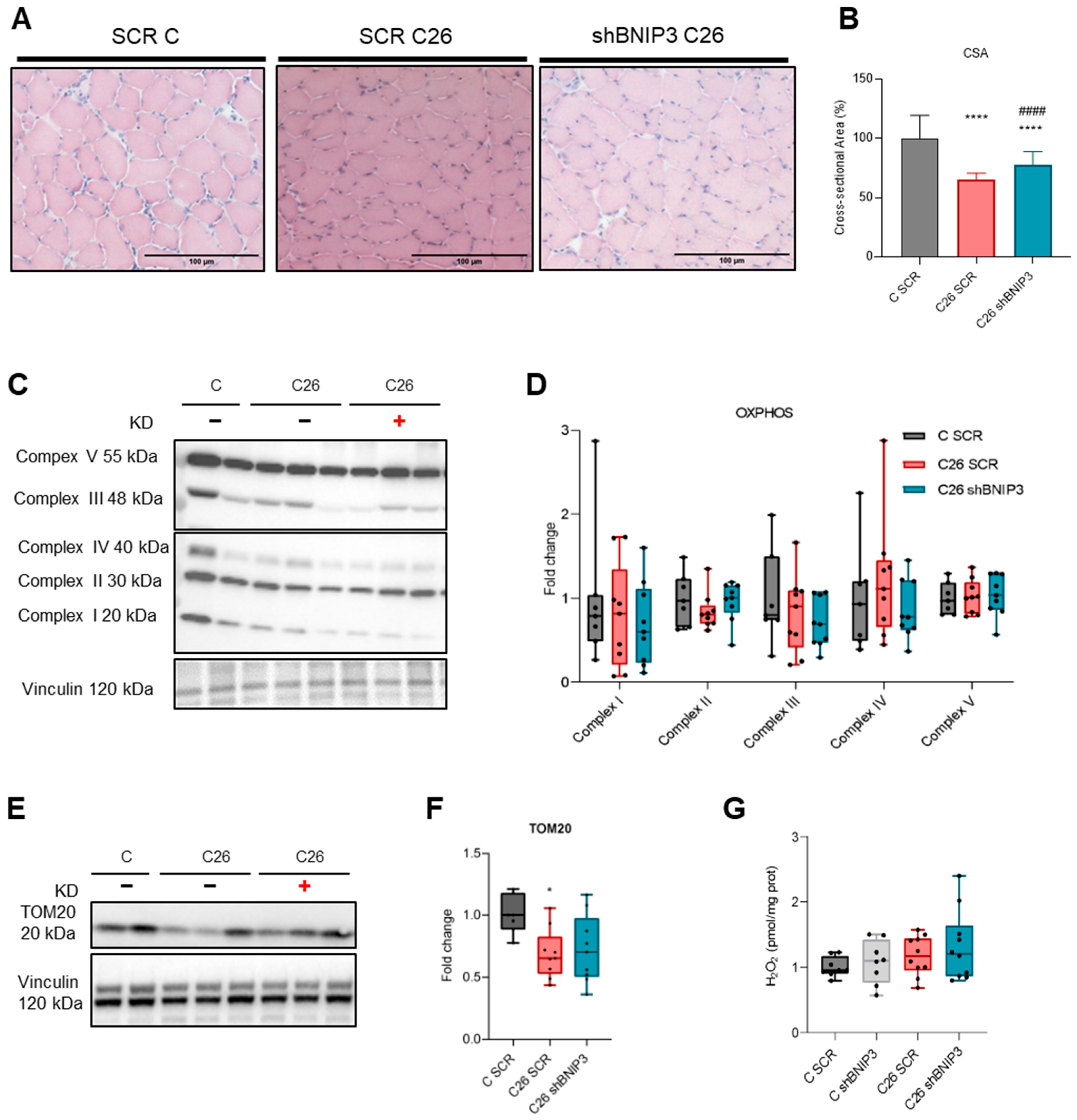 Cancers 16 04133 g004