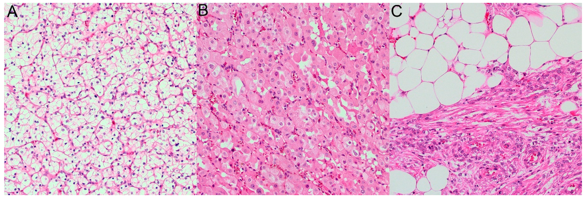 Cancers 16 04139 g001