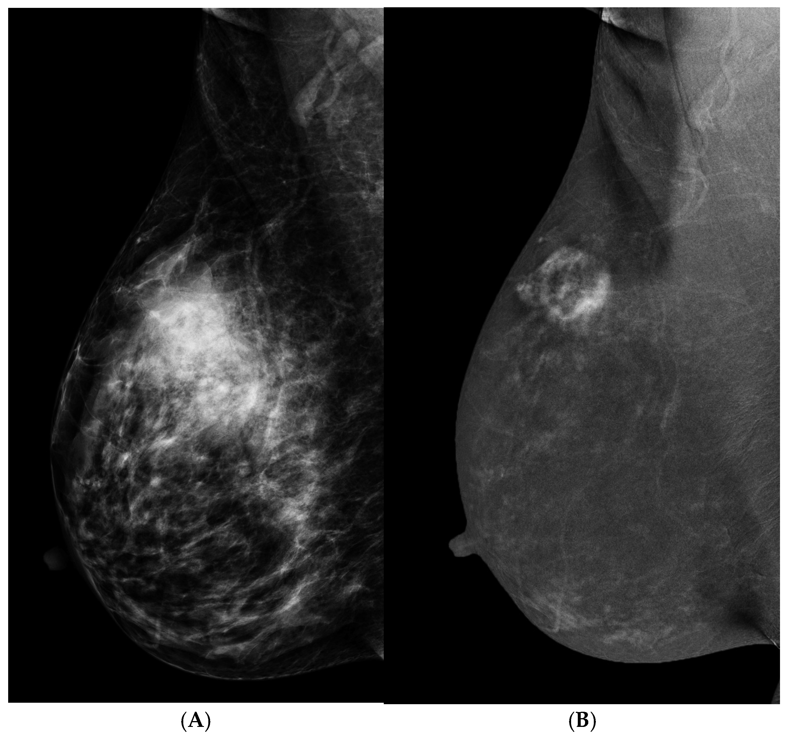 Cancers 16 04143 g002