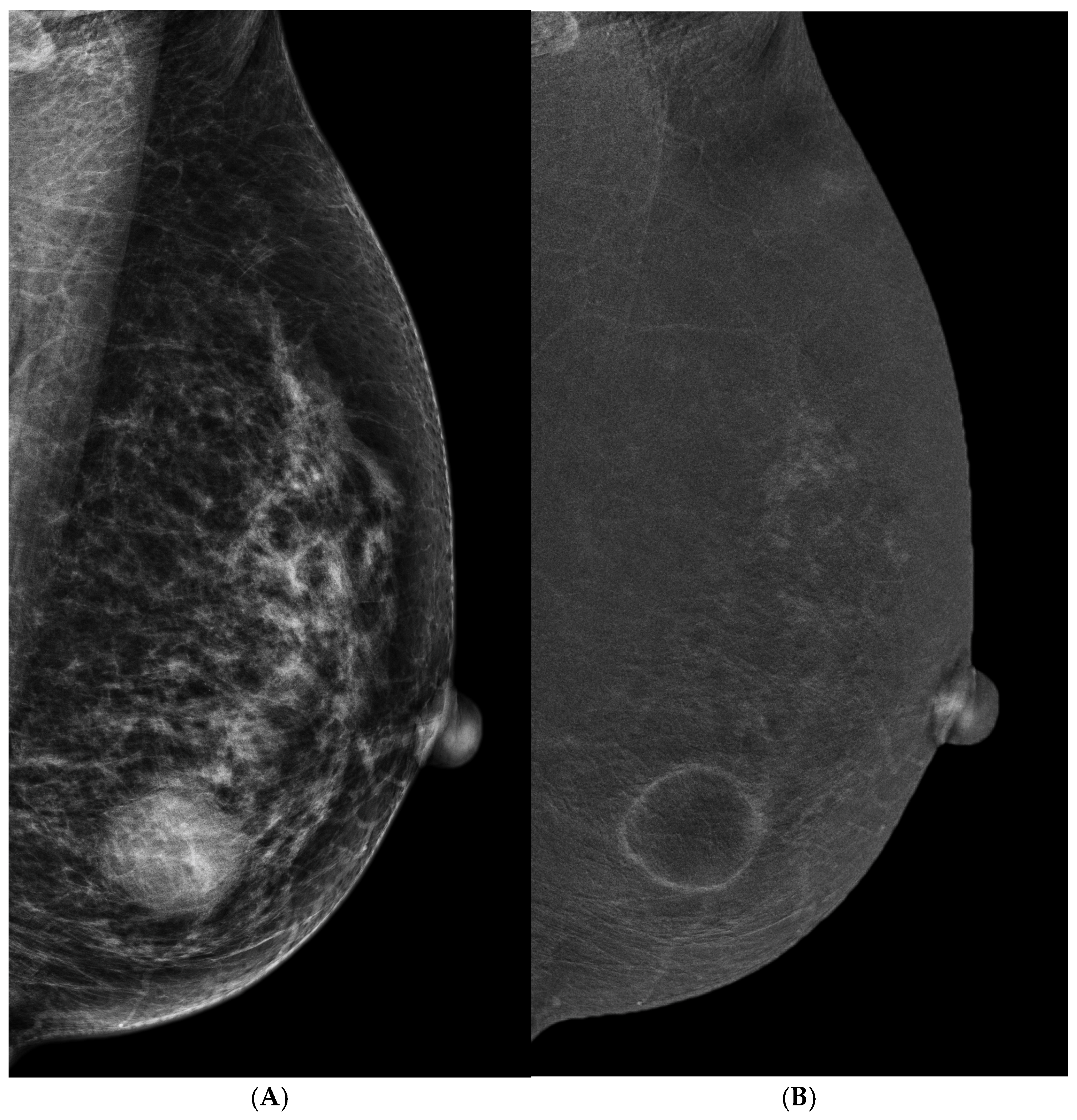 Cancers 16 04143 g003