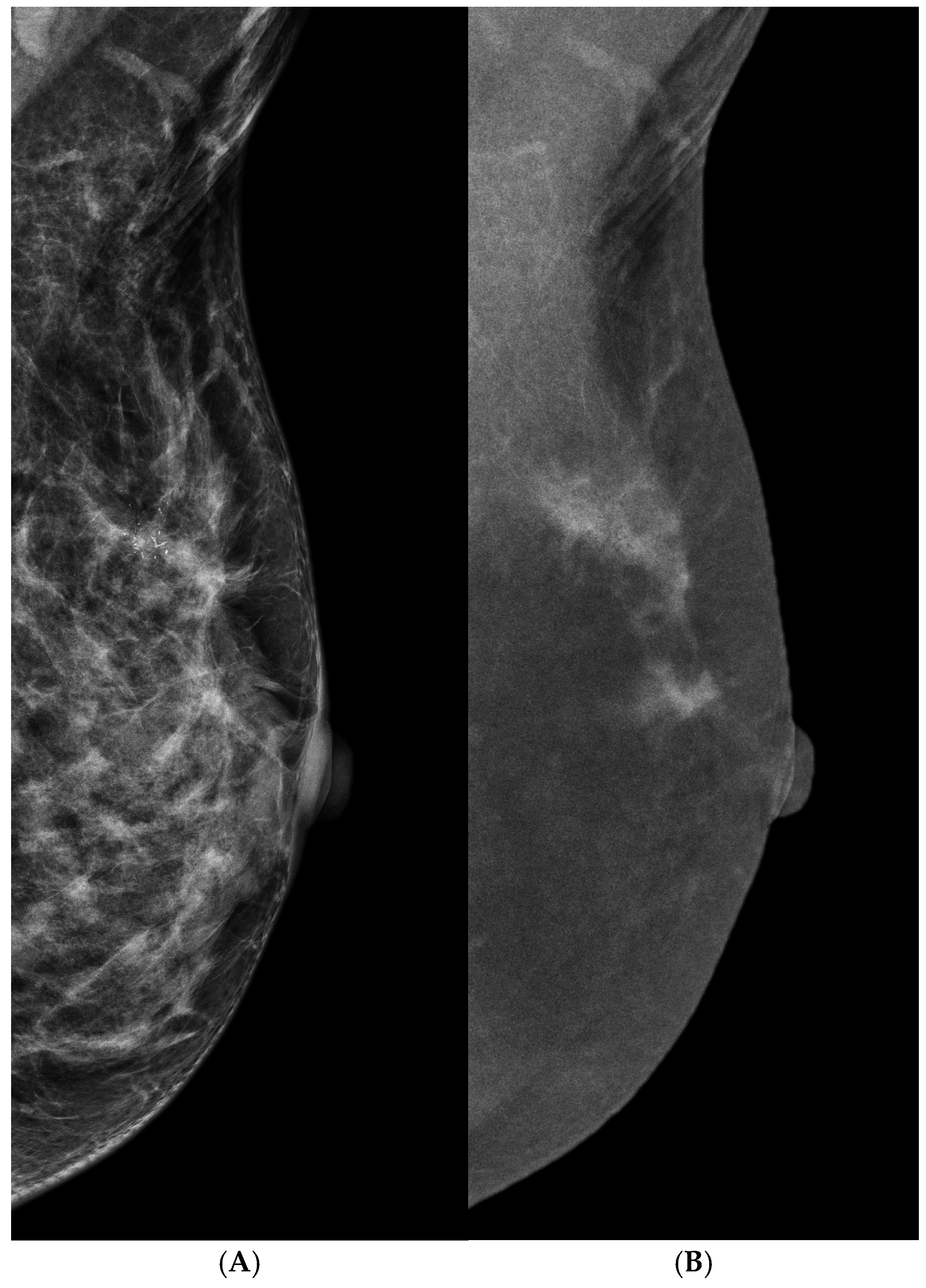 Cancers 16 04143 g004