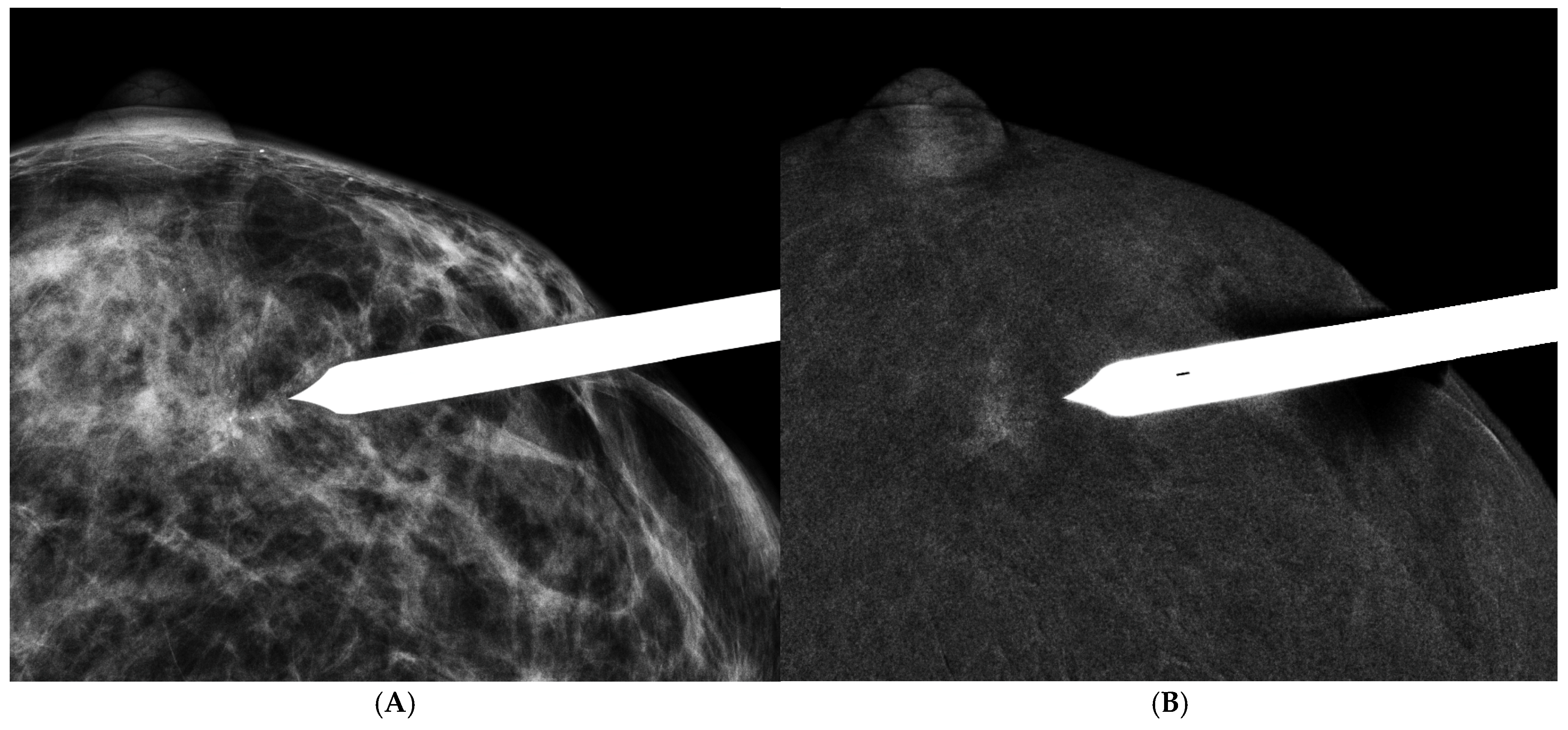 Cancers 16 04143 g005