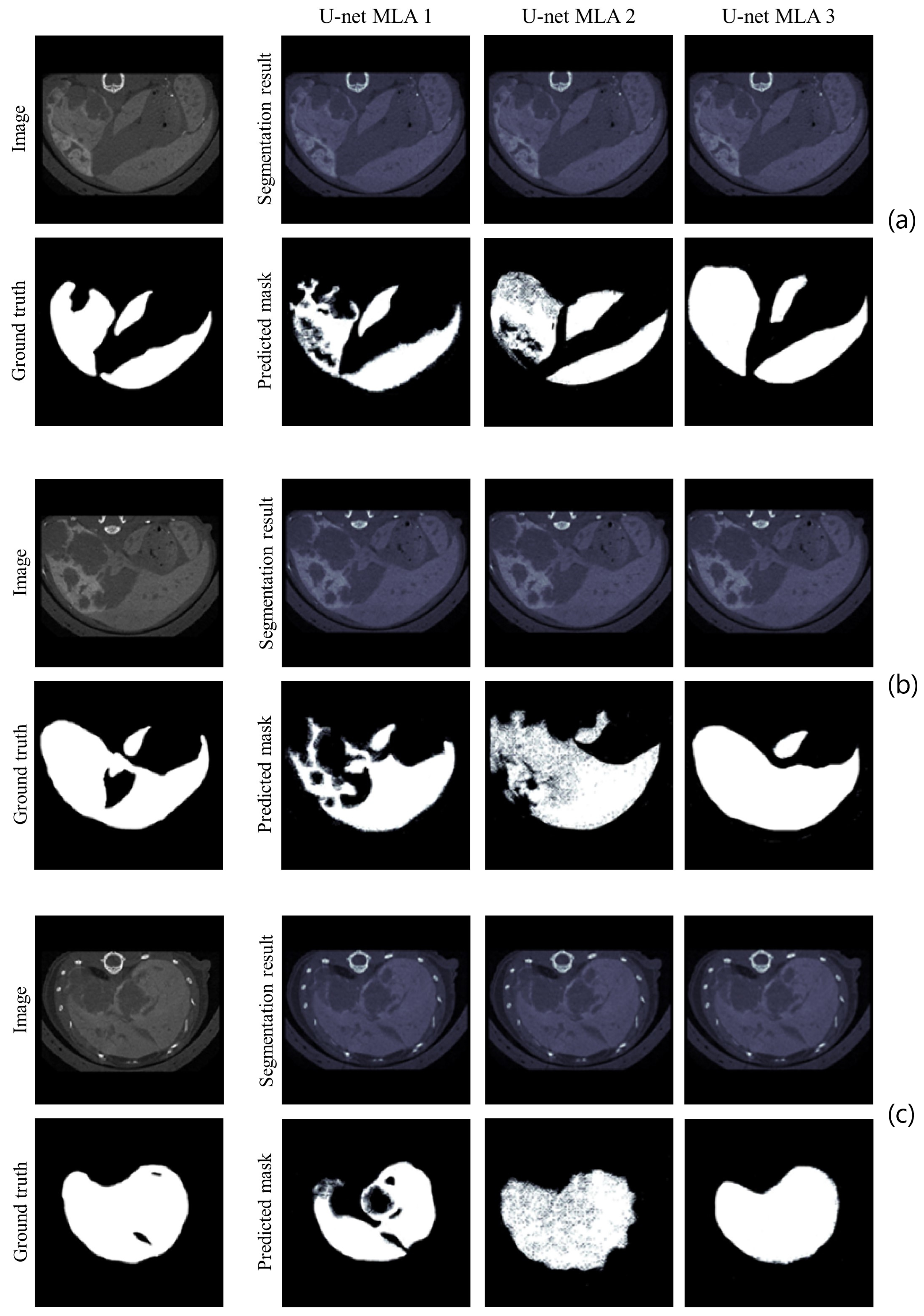 Cancers 16 04159 g004