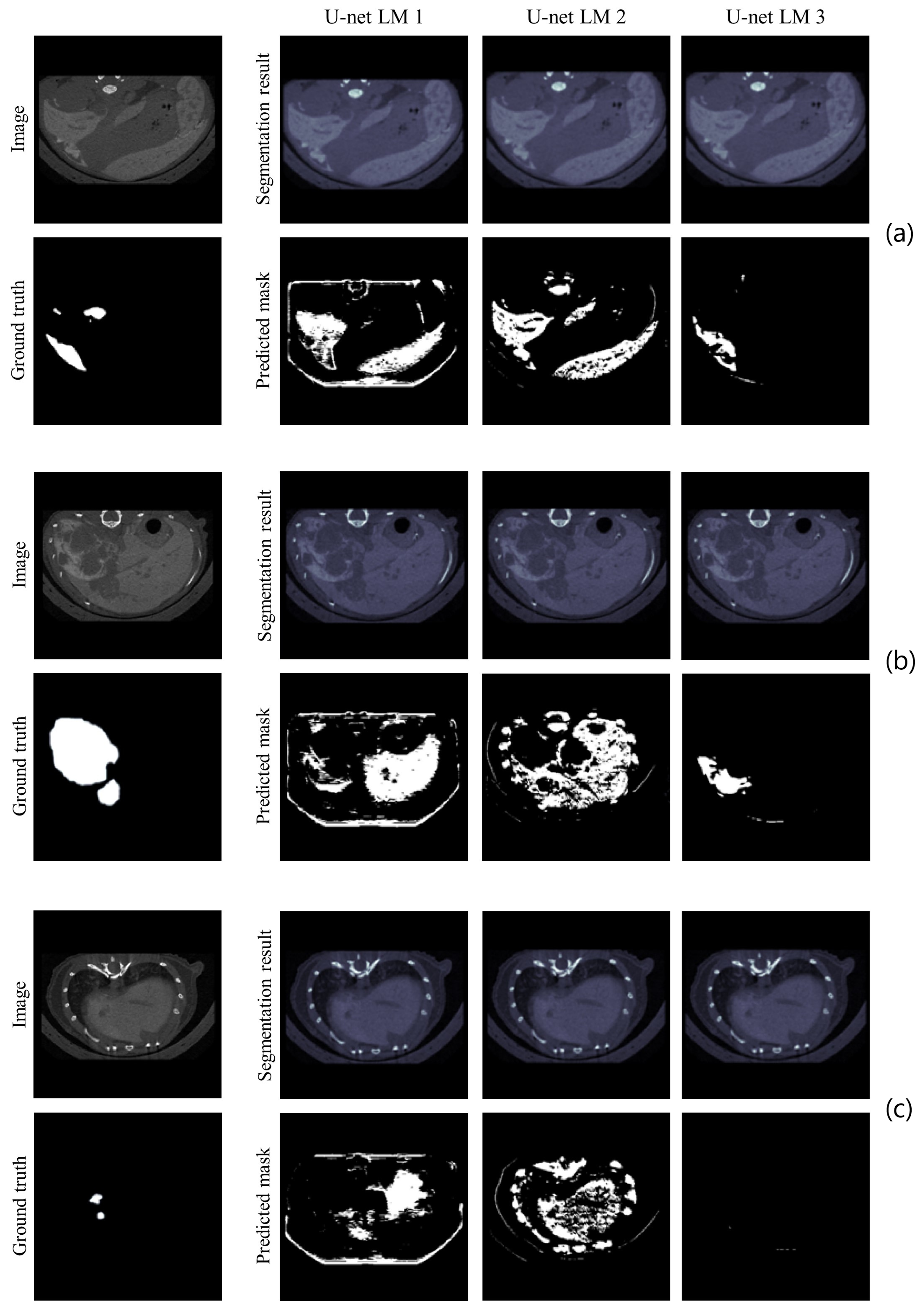 Cancers 16 04159 g005