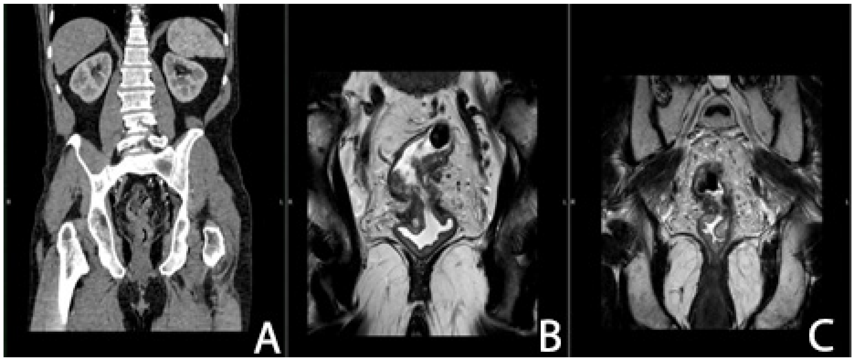 Cancers 16 04175 g004