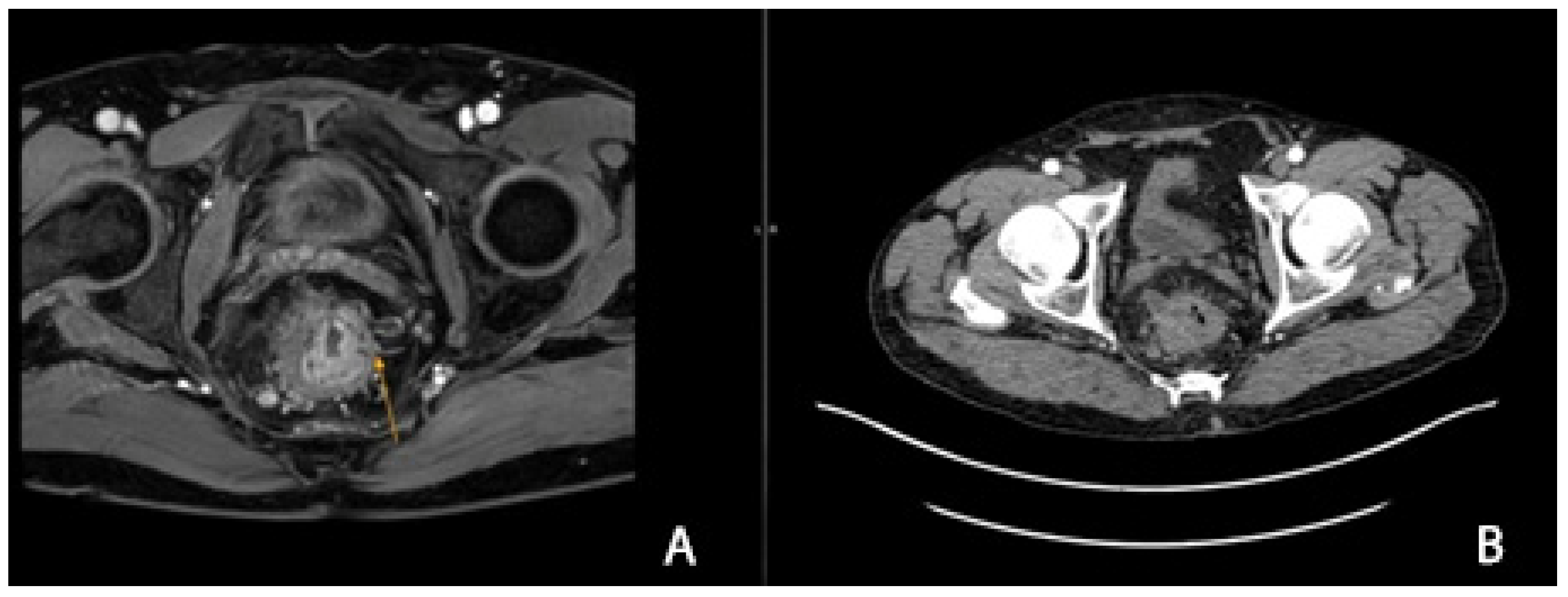 Cancers 16 04175 g005