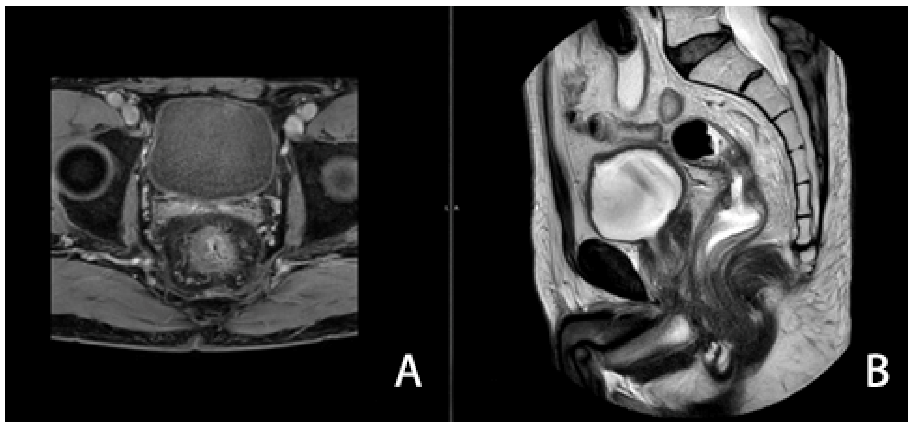Cancers 16 04175 g006