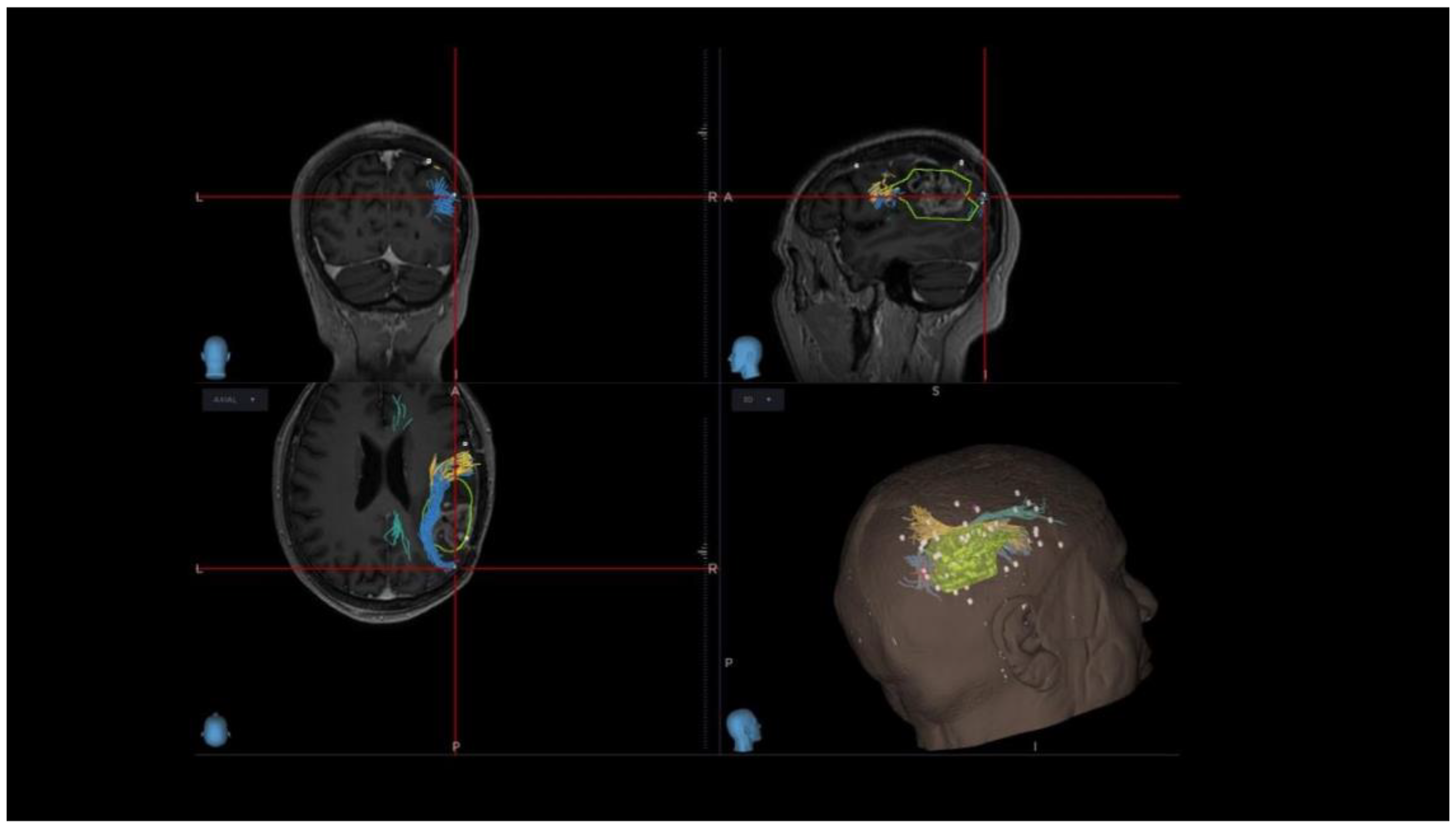 Cancers 16 04250 g007