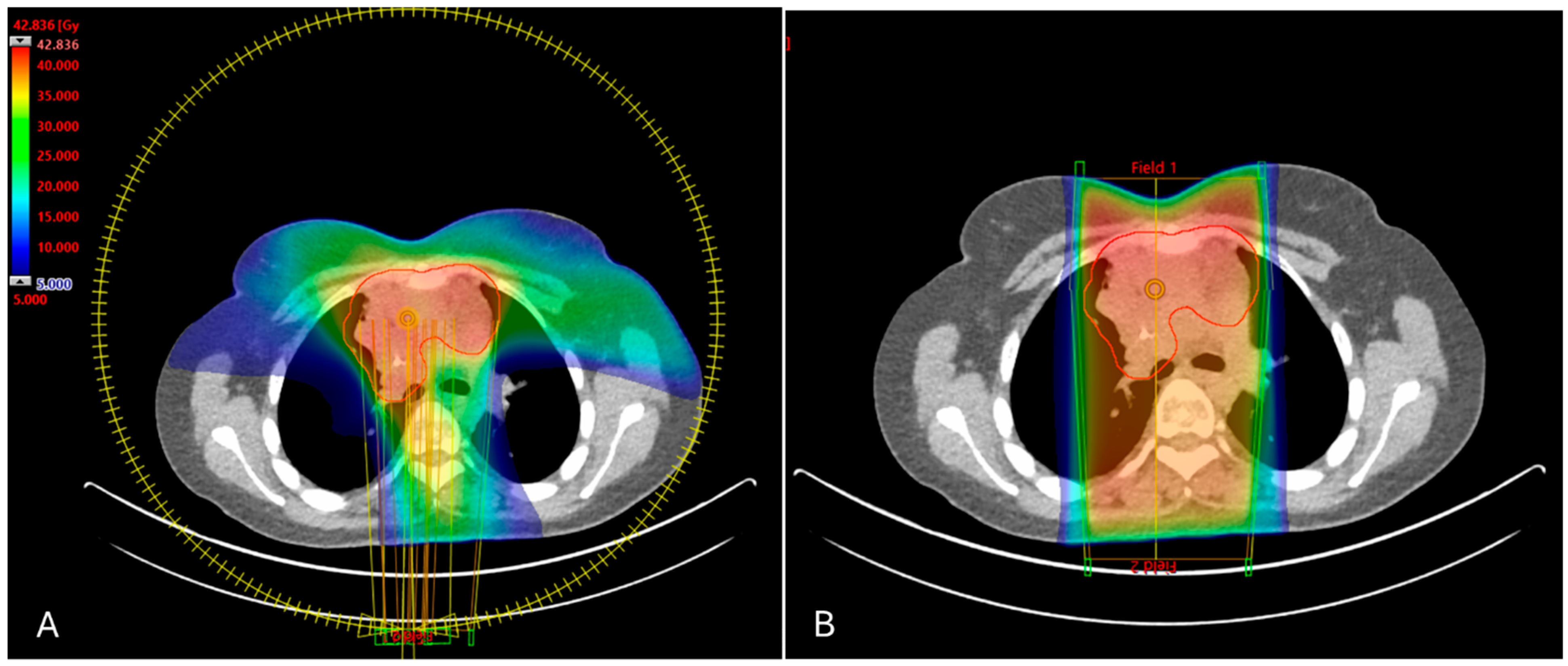 Cancers 16 04265 g001