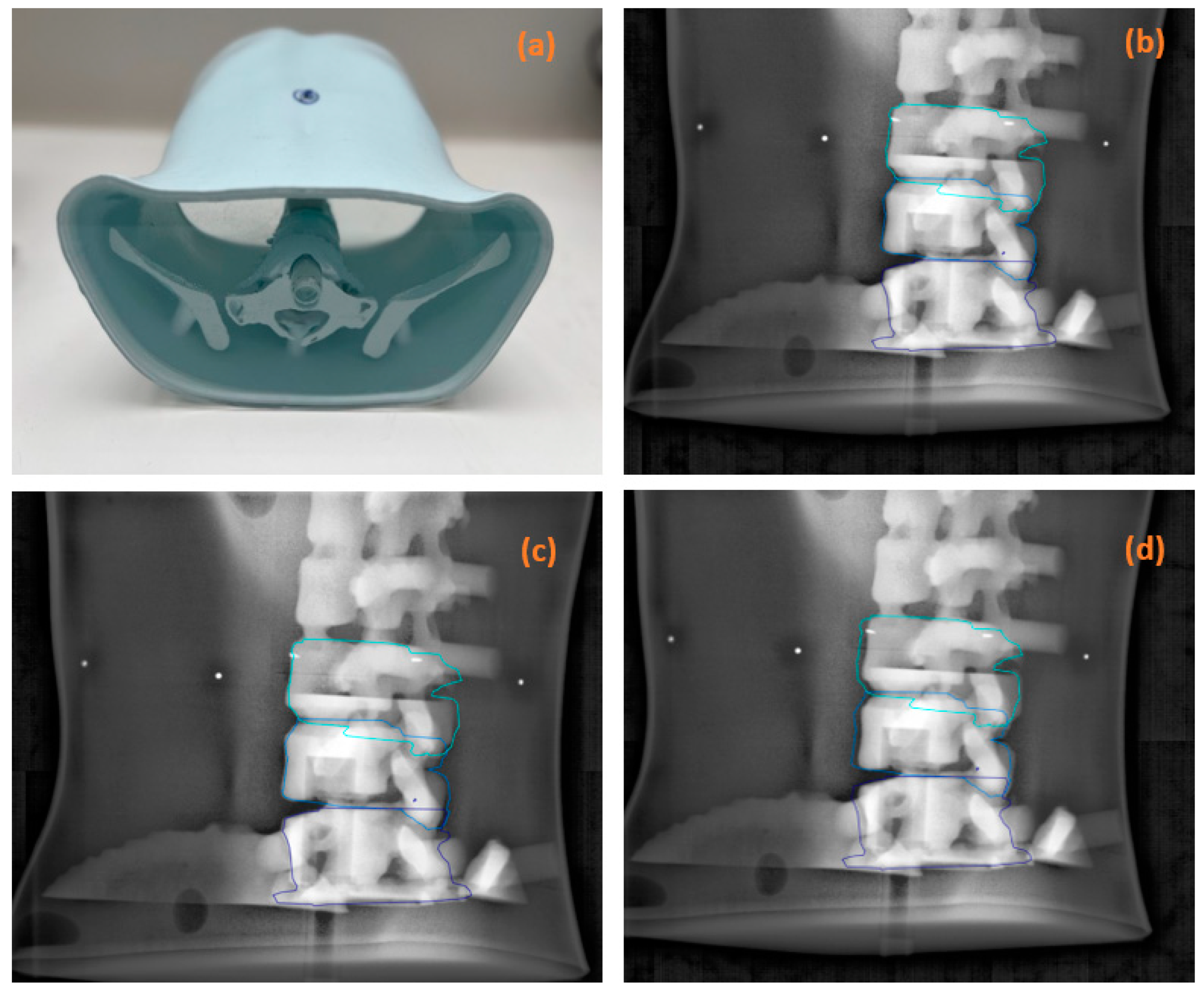 Cancers 16 04267 g001