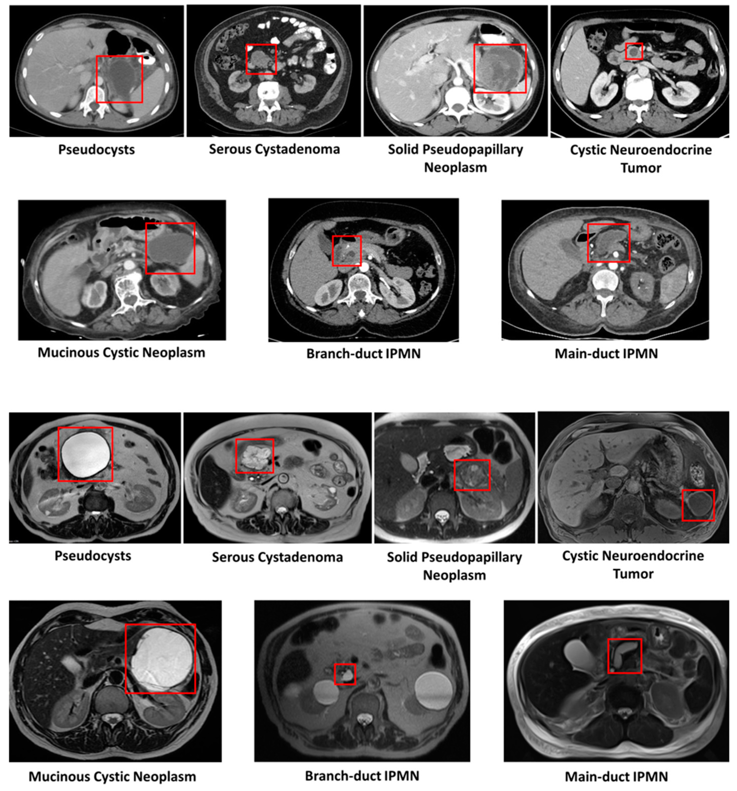 Cancers 16 04268 g003