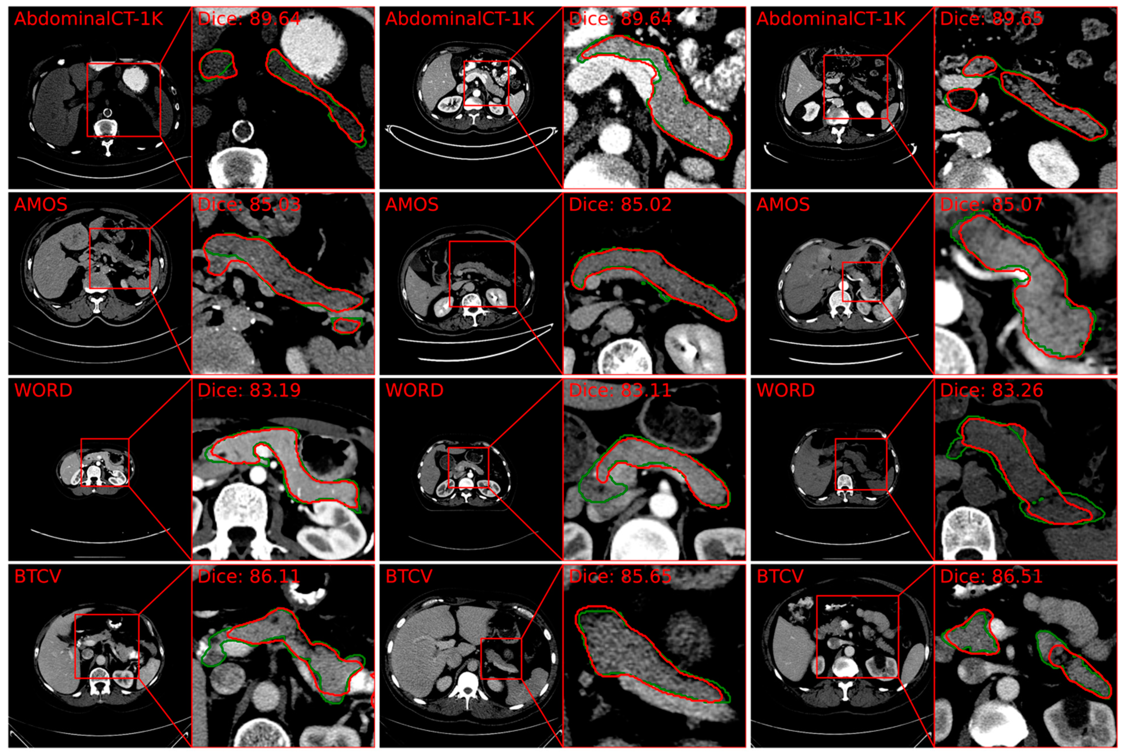 Cancers 16 04268 g004a