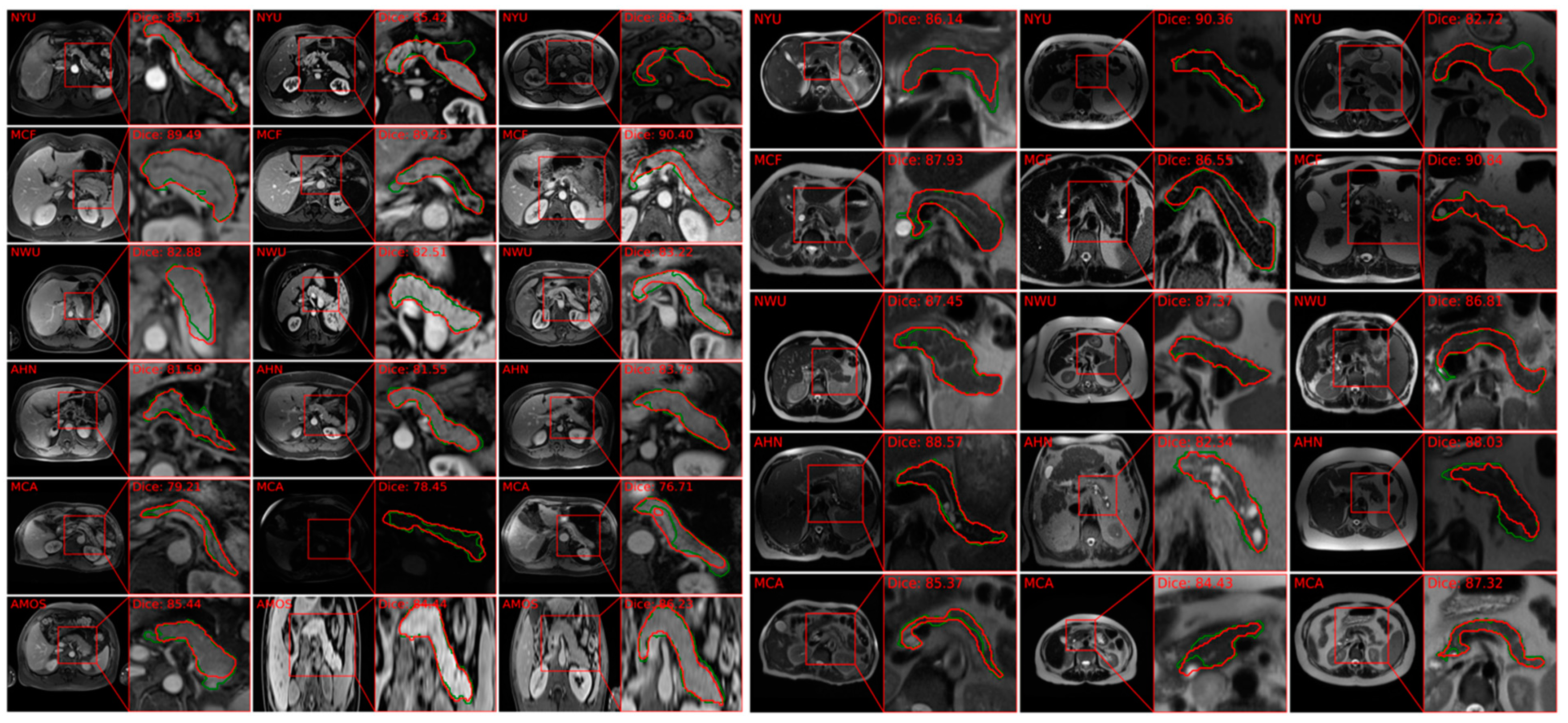 Cancers 16 04268 g004b