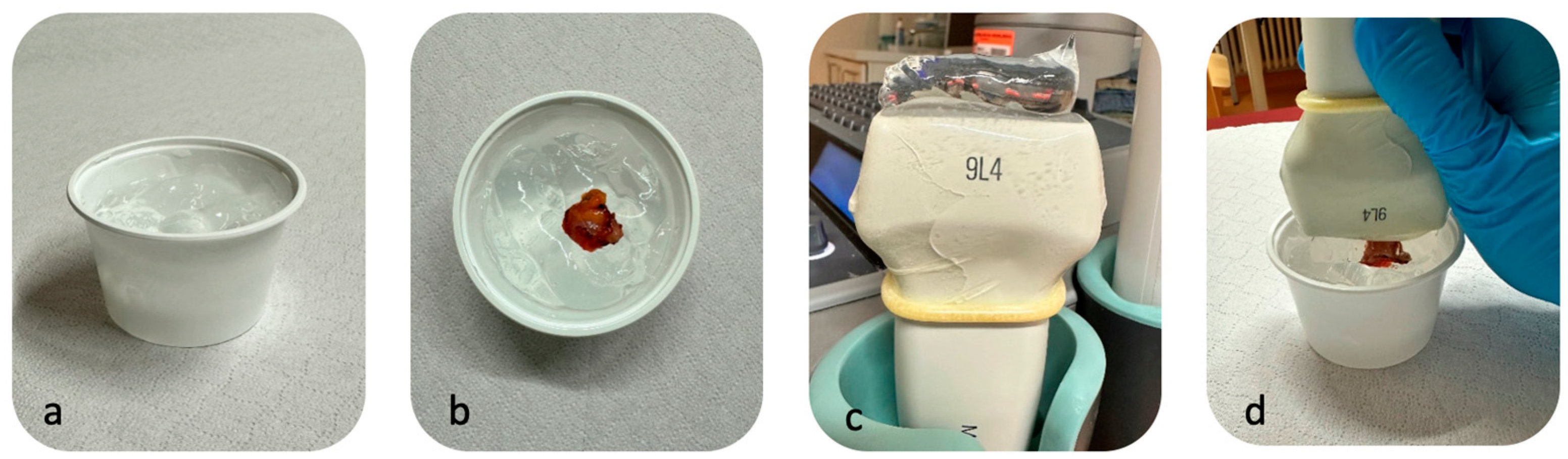 Cancers 16 04270 g001 Cancers 16 04270 g001