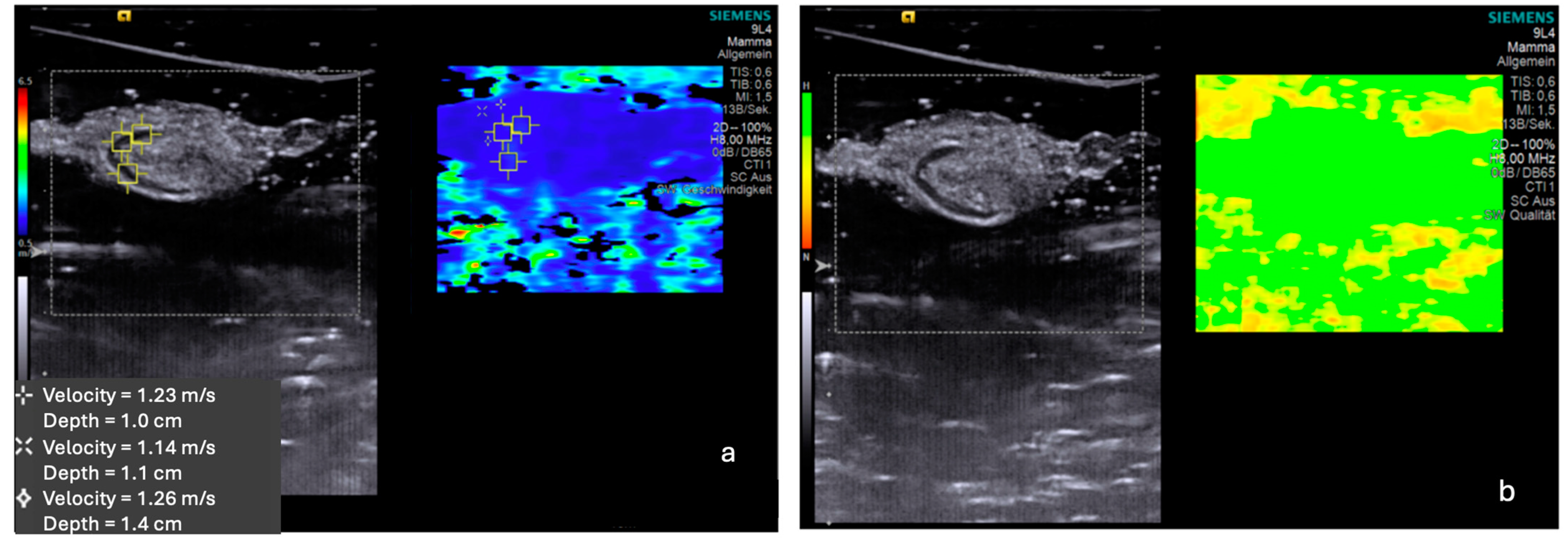 Cancers 16 04270 g002 Cancers 16 04270 g002