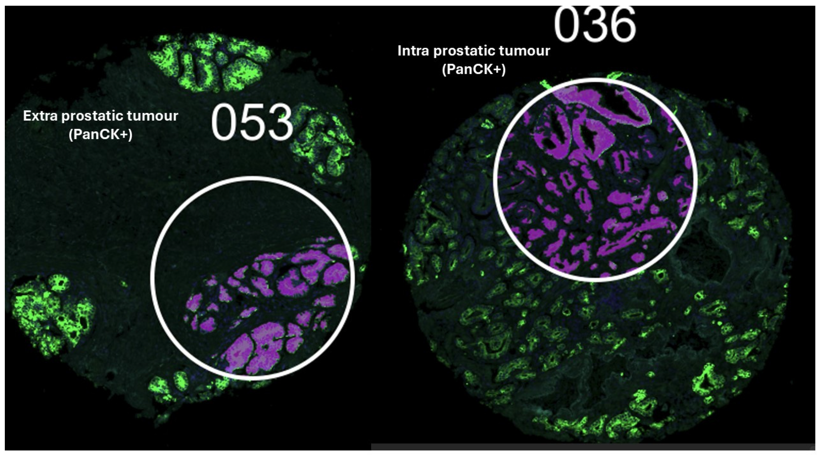 Cancers 17 00002 g001