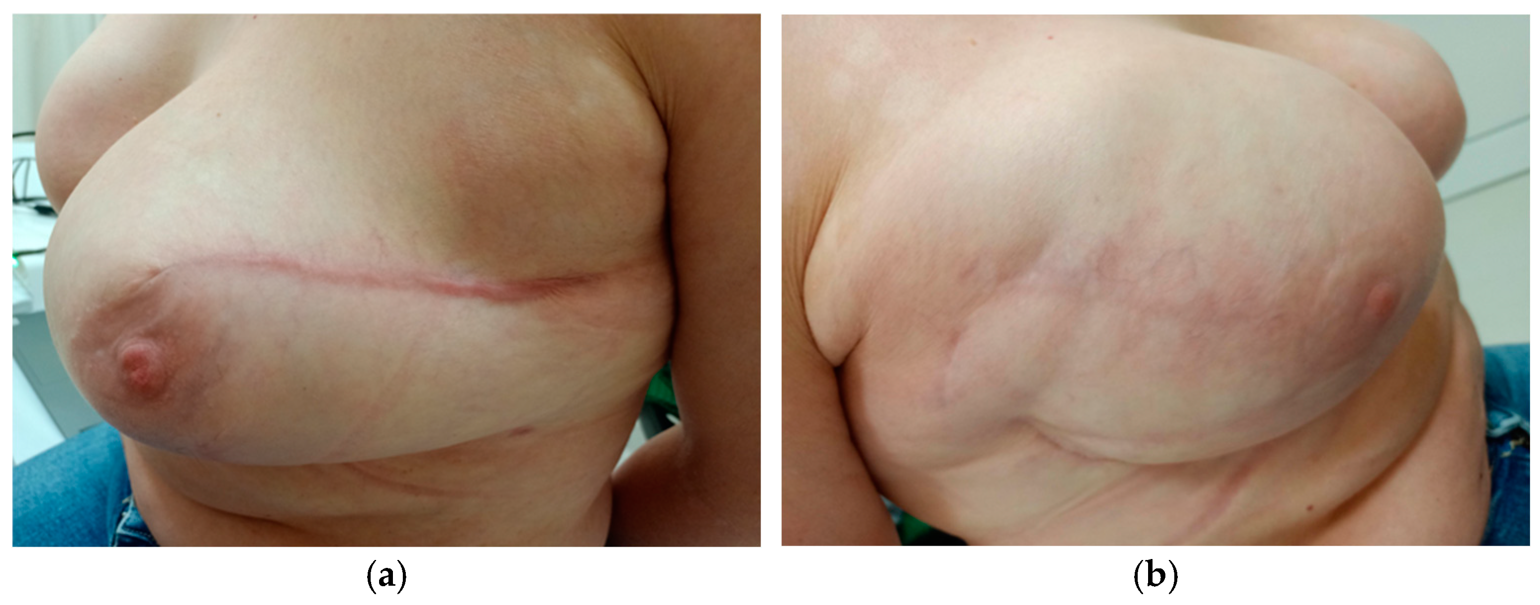 Cancers 17 00003 g008