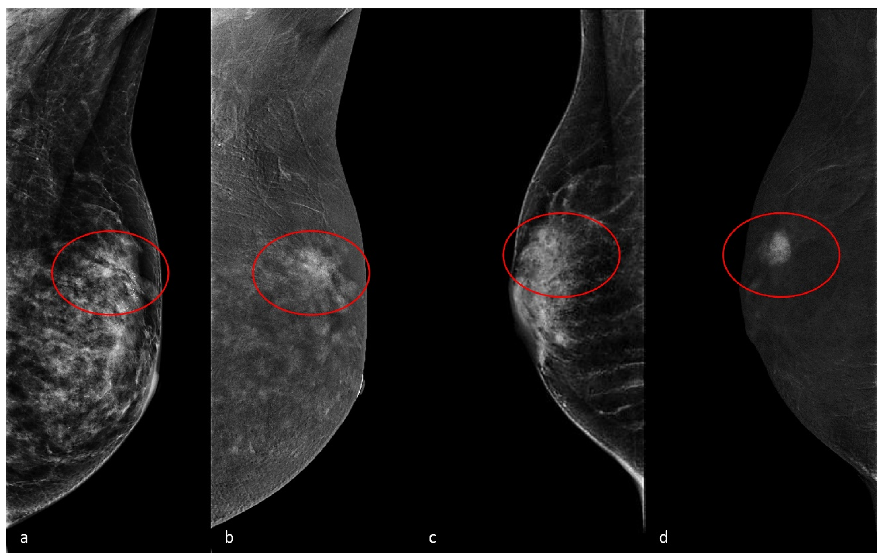 Cancers 17 00011 g003