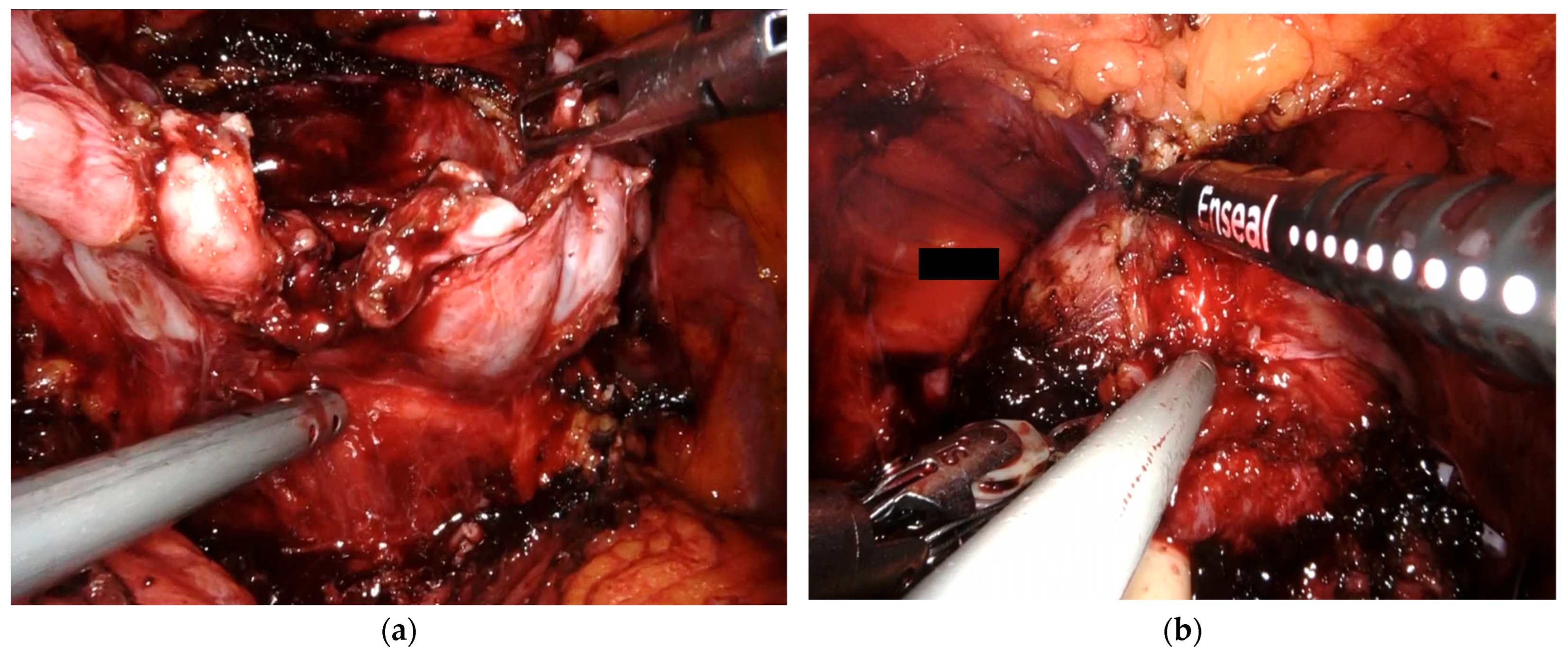 Cancers 17 00020 g003