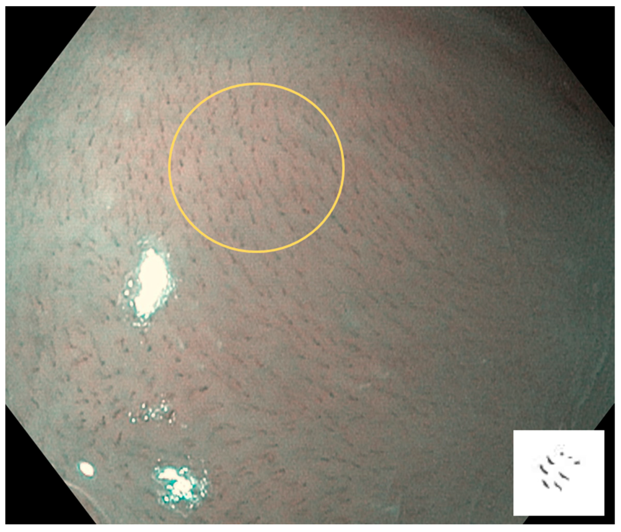 Cancers 17 00021 g002 Cancers 17 00021 g002